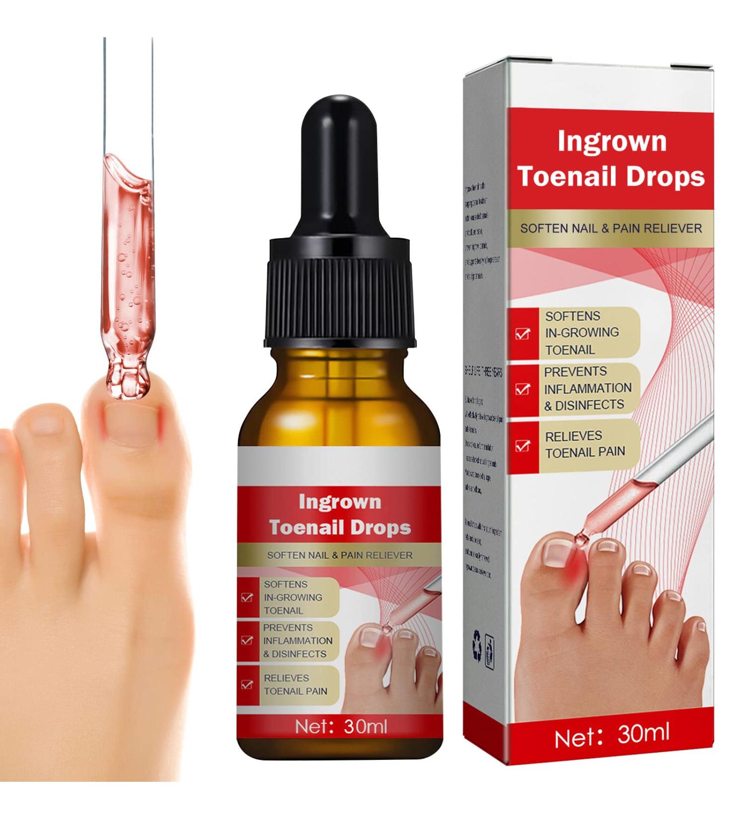 Professional Ingrown Toenail Treatment Drops | Easy Trimming & Softening | Pin Reduction | 30ml - Buy Online on GoSupps.com