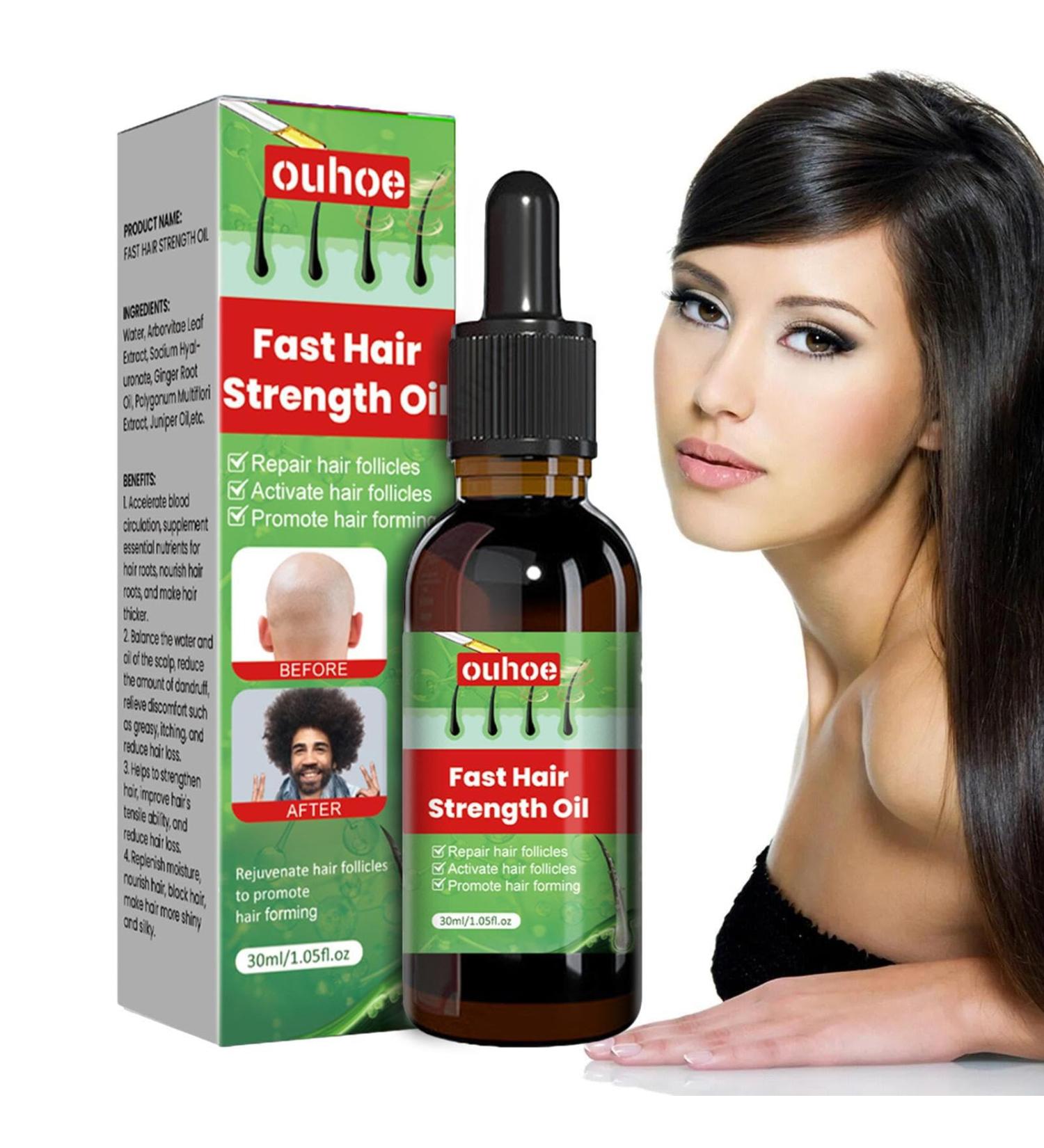 Essential Oil for Hair Density & Growth - 30ml Aibyks Natural Wild Hair Growth Oil - Buy Online on GoSupps.com