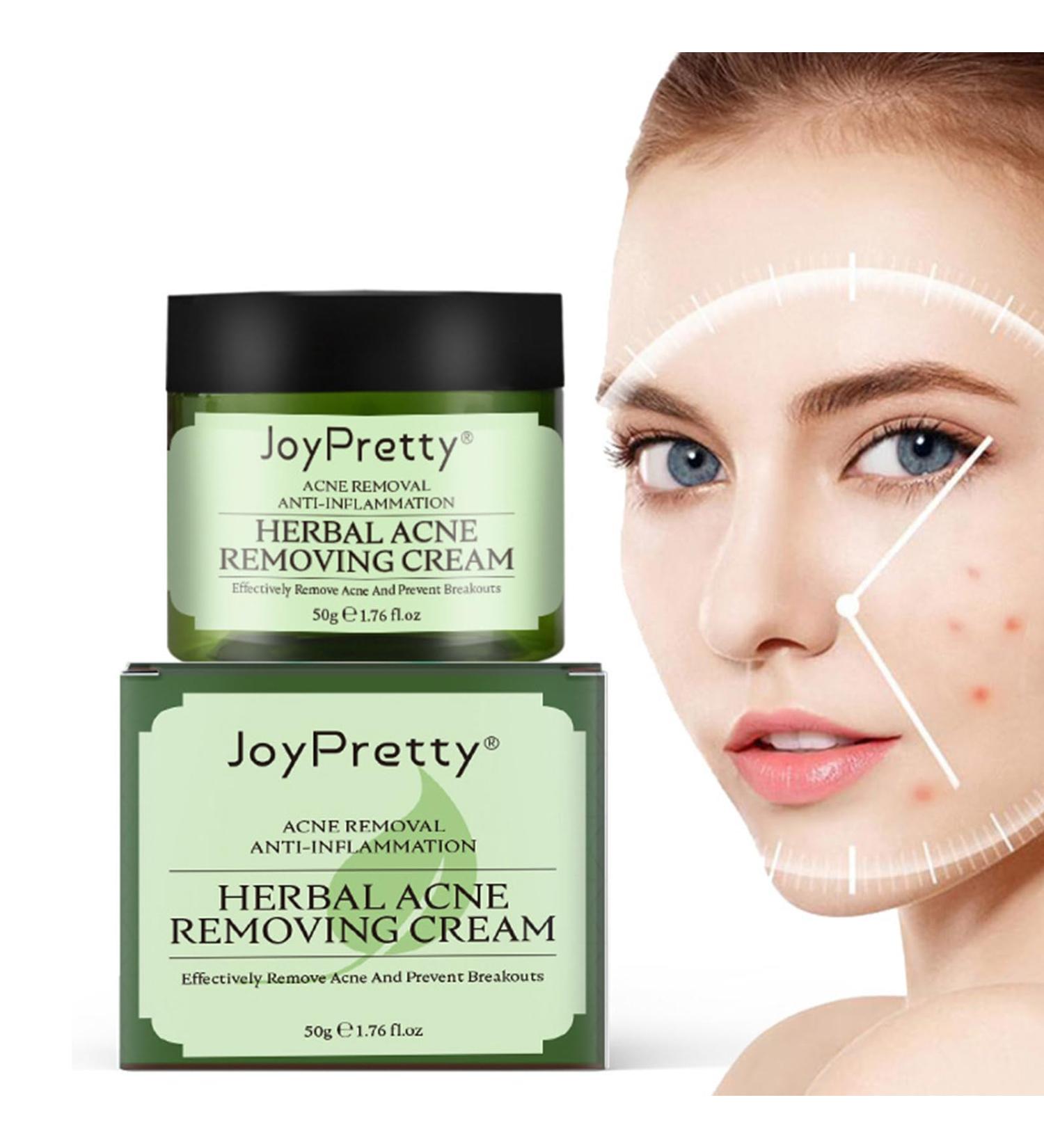 Effective Acne Treatment Face Cream | Herbal Spot Treatment for Teens & Adults | Remove Acne Marks & Moisturize Skin - Buy Online on GoSupps.com