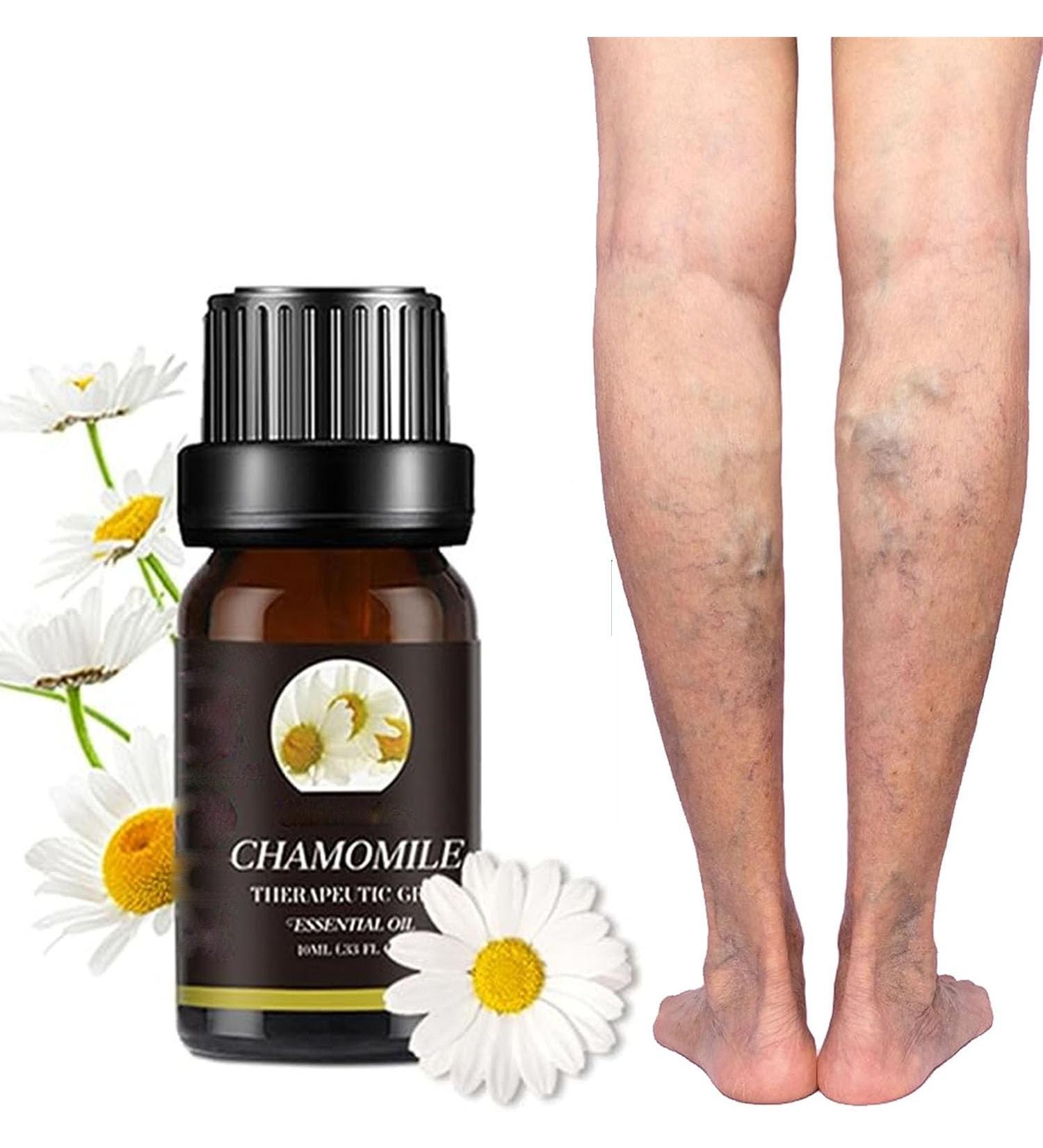 Marrony Oil for Varicose Veins - Essential Marricon-Haramille Treatment for Improved Blood Circulation (5 Pieces) - Buy Online on GoSupps.com