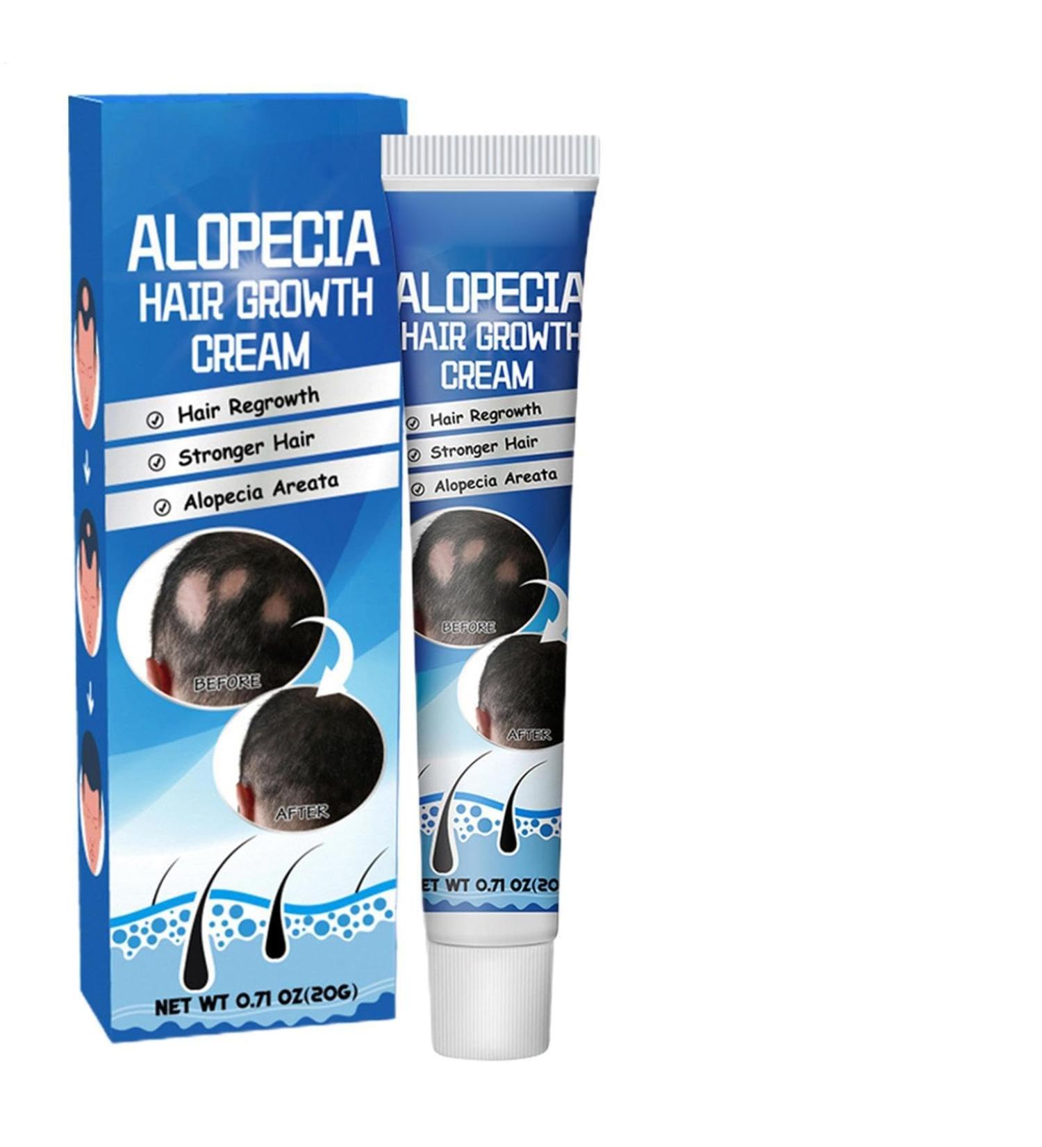  Generisch Areata Anti-Alopecia Cream - Repairing Cream for Hair Regrowth with Sophora Flavescens | Scalp Treatment for Baldness and High Hairline | Natural Formula - Buy Online on GoSupps.com