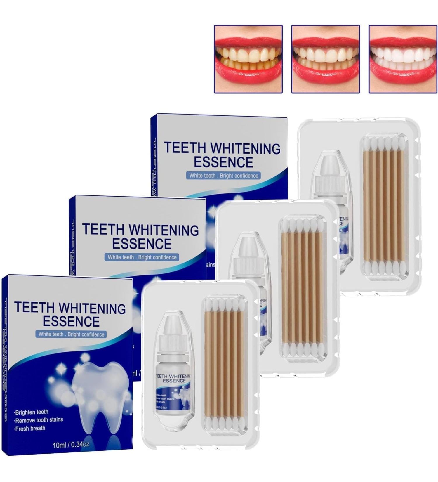 Pure Smile Essence Teeth Whitening Enhancer At-Home Whitening System Professional Teeth Whitening Powerfully Removes All Kinds of Stains - Buy Online on GoSupps.com