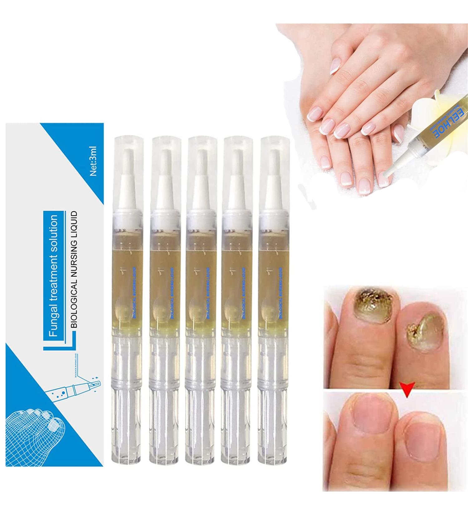 Okita Toenail Fungus Treatment Pen - Effective Nail Repair for Healthy and Strong Nails (5Pcs) - Buy Online on GoSupps.com