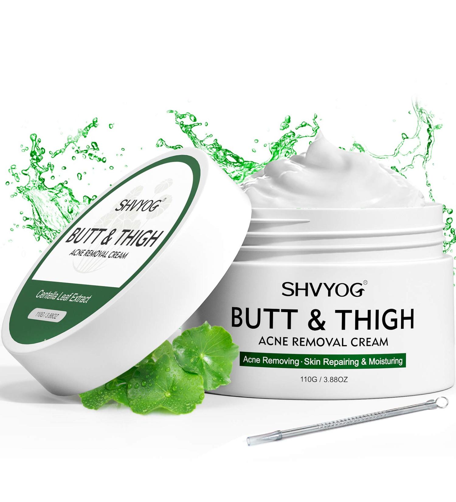 Acne Treatment Cream for Butt & Thigh - Removes Pimples, Ingrown Hairs - Spot & Cystic Acne Treatment - Moisturizes and Repairs Skin - Buy Online on GoSupps.com
