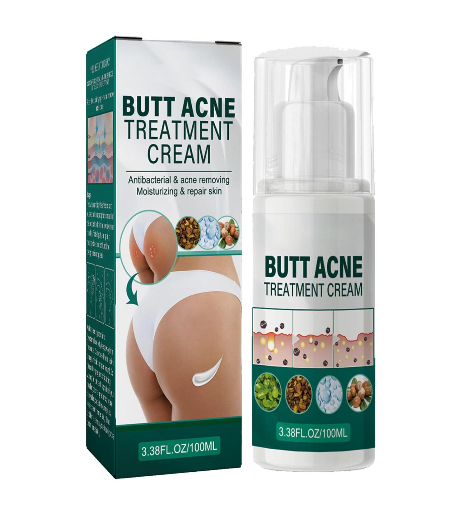 Cr me Nettoyante Acn Fesses et Cuisses Cr me pour les Boutons des Fesses Nettoyage Cr me Dissolvant de Boutons pour les Fesses 100ML 1PC - Buy Online on GoSupps.com