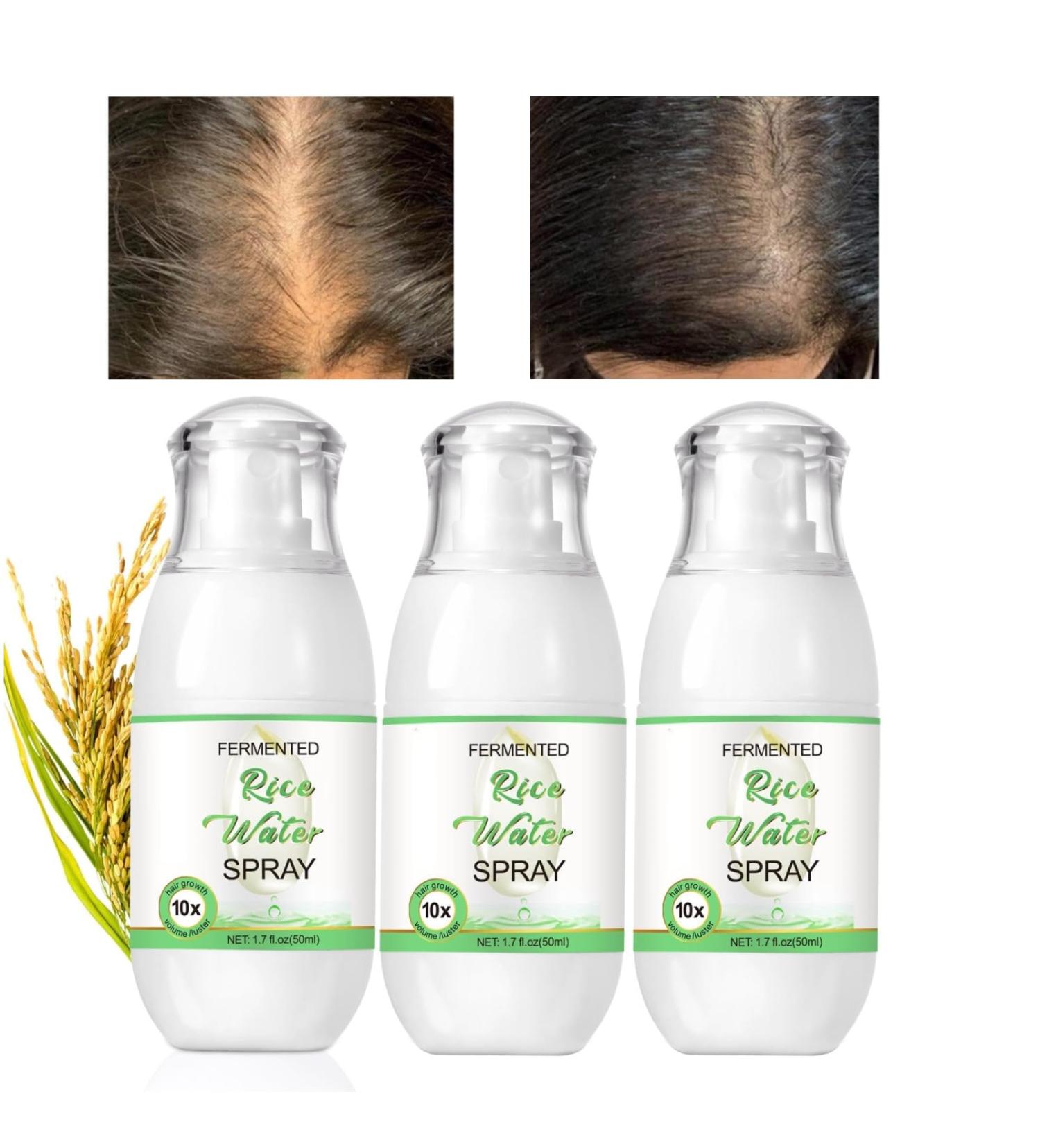 Eau De Riz Ferment Regime Pour la Croissance des Cheveux Naturel V g talien Eau de Riz Spray Spray D'eau De Riz Ferment Adapt Aux Cheveux Secs Et Boucl s 50 ml (3pcs) Cam lia 50 ml (Lot de 1) - Buy Online on GoSupps.com