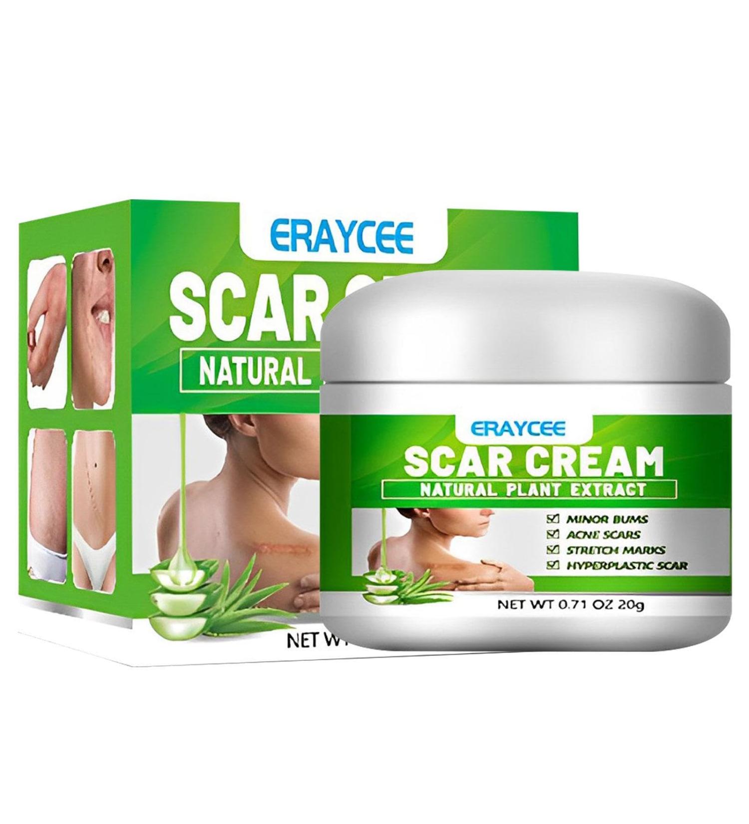 Scar Gel | Natural Calming Moisturizing Aloe Gel for Skin Lightening - Professional Scar Eraser Non-greasy Scar Repair Skin Care for Wounds Sysdisen - Buy Online on GoSupps.com