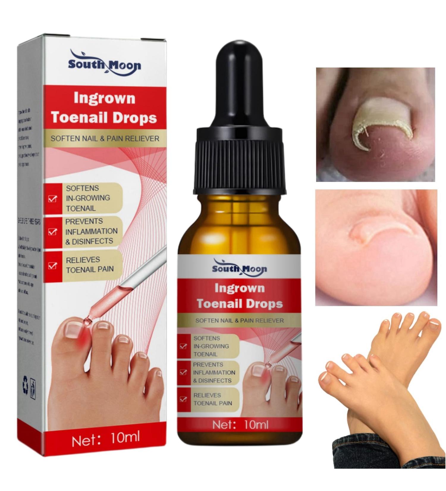 Ingrown Toenail Treatment Oil - Anti Paronychia Relief & Nail Growth Formula - Buy Online on GoSupps.com