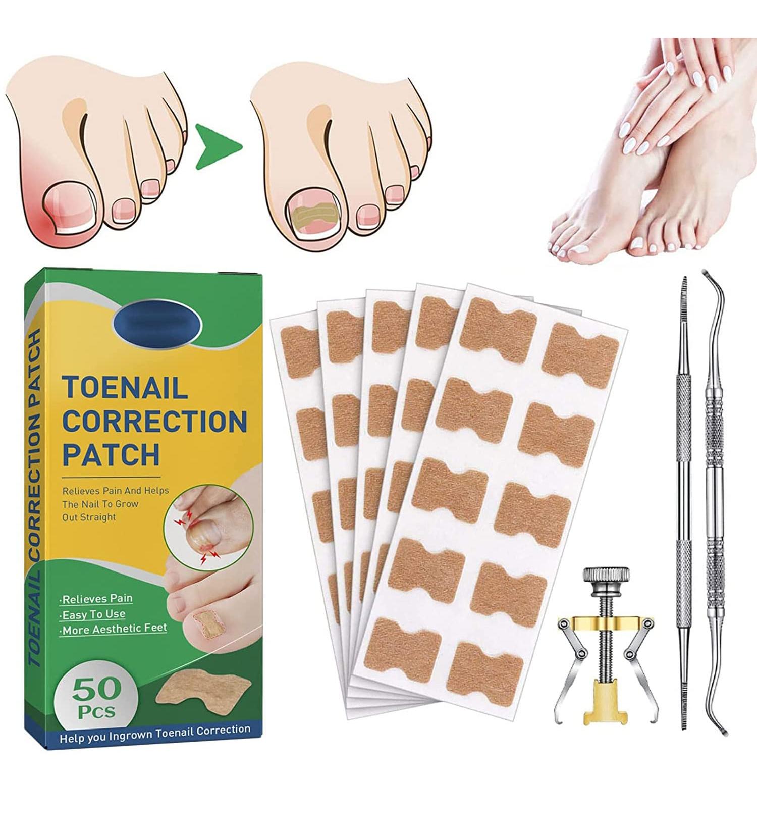 Fitmedify Ingrown Toenail Corrector Kit - Nail Patches for Ingrown Toenail Treatment and Removal - Buy Online on GoSupps.com