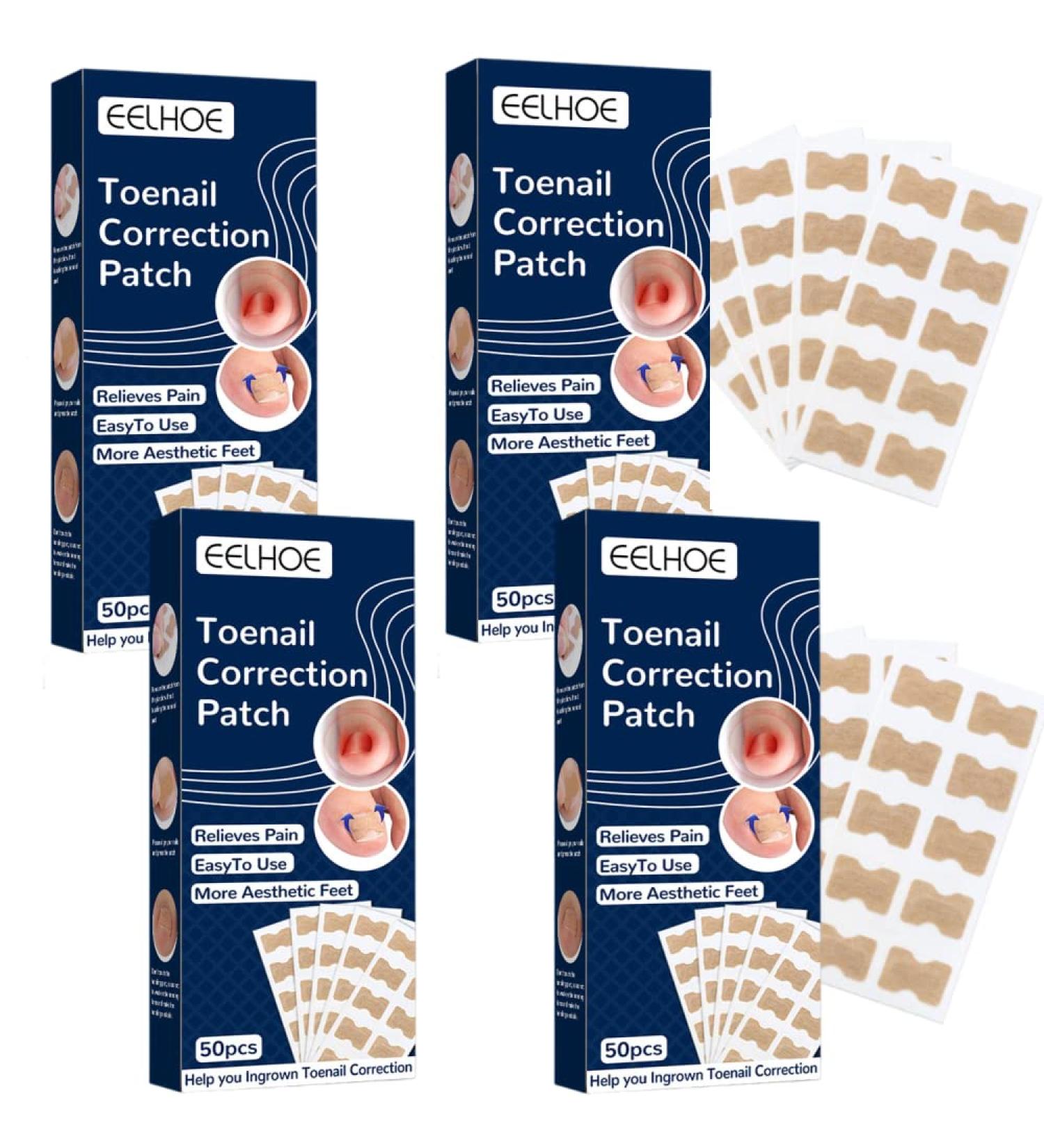 200 Pieces Ingrown Toenails Stickers Toenail Correction Patch Glue-Free Ingrown Curved Toenail Lifter Foot Care Treatment Pedicure Tool (A) - Buy Online on GoSupps.com