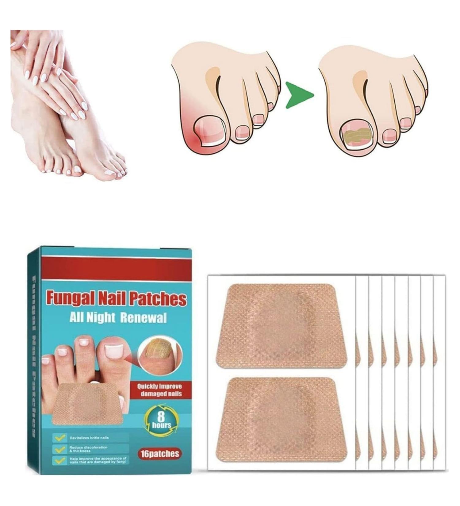 2024 New 3Boxes/48pcs Anti Fungus Nail Treatment Patches Toe Fungus Onychomycosis Repair Sticker Nail Patches - Buy Online on GoSupps.com