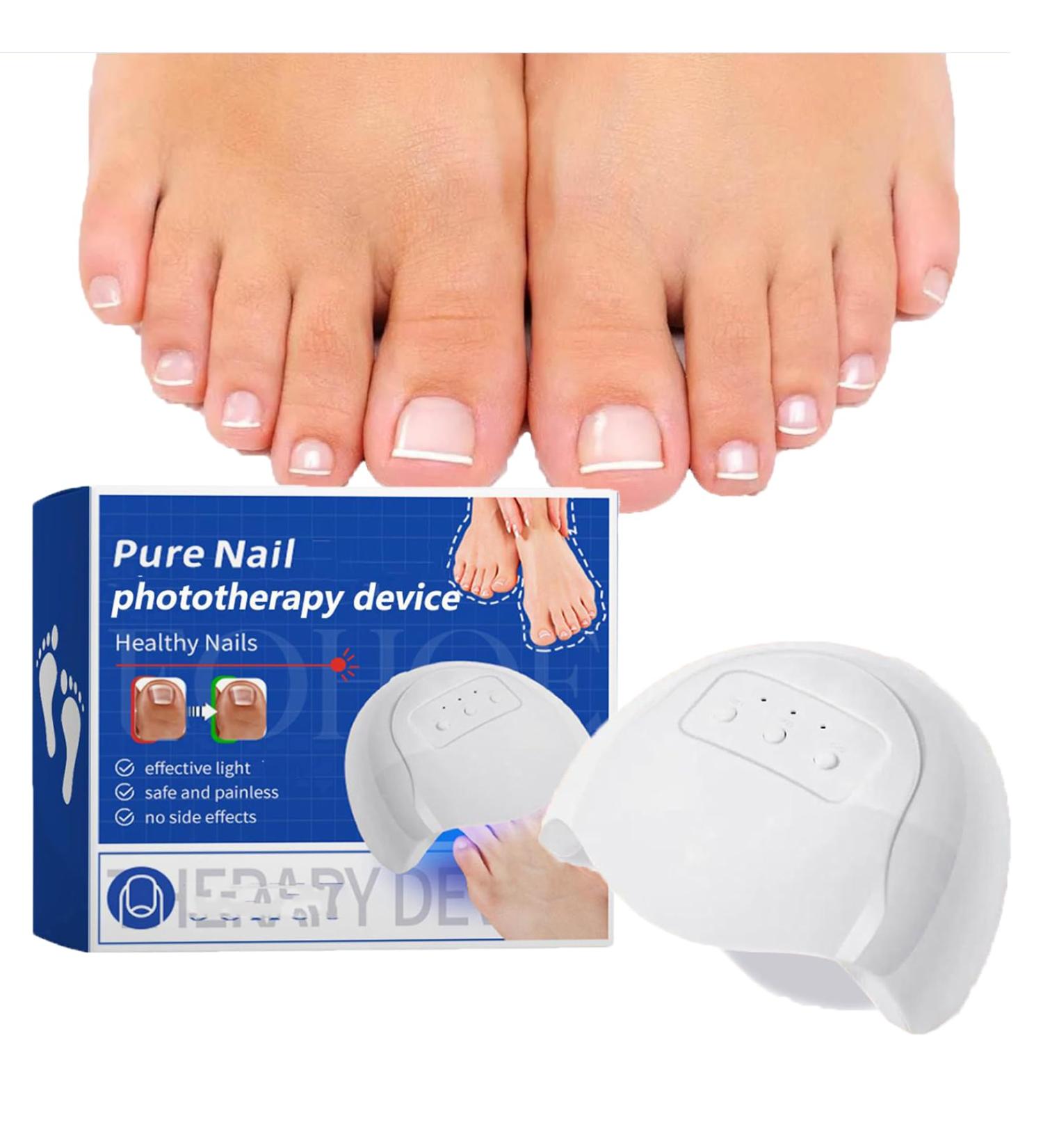 Furzero Nail Fungus Laser Nail Fungus Treatment Device Purenail Mushroom Laser Therapy Device Fivfivgo Light Therapy Device for Nail Fungus Nail Fungus Laser Treatment Device for Cleaning and Care of - Buy Online on GoSupps.com