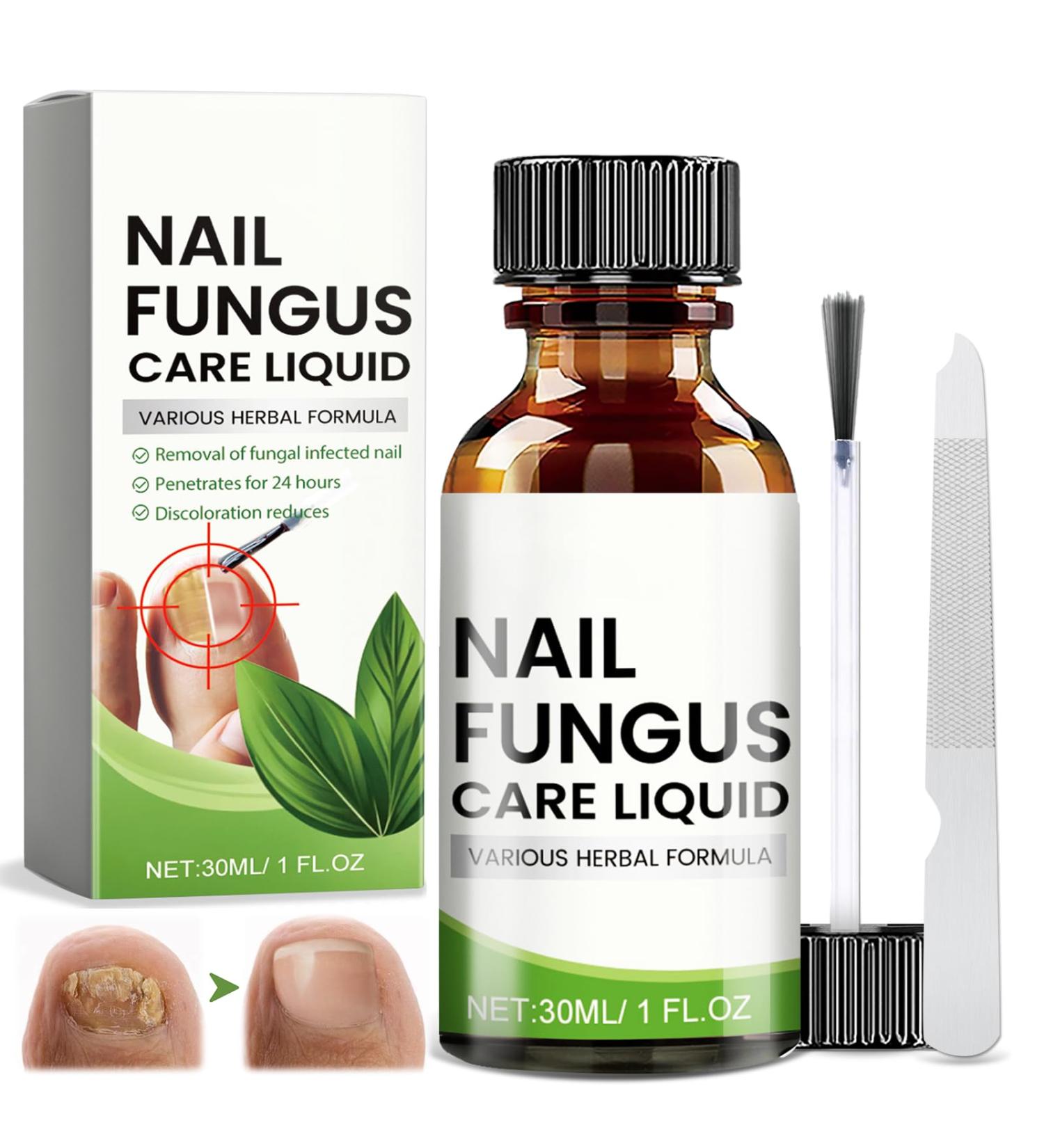 Toenail Care with Nail File Nourishing and Soothing for Nails Promotes the Regrowth of Healthy Nails 30ml - Buy Online on GoSupps.com