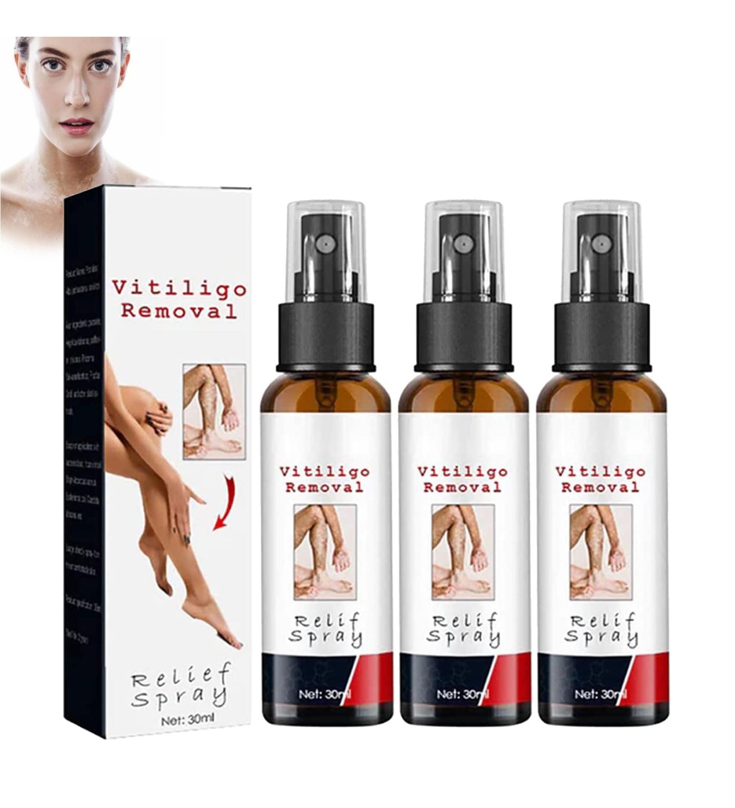 Kolmax Alkyne Psoriasis and Vitiligo Relief Spray - Reduces White Spots on Skin - 3PCS - Buy Online on GoSupps.com