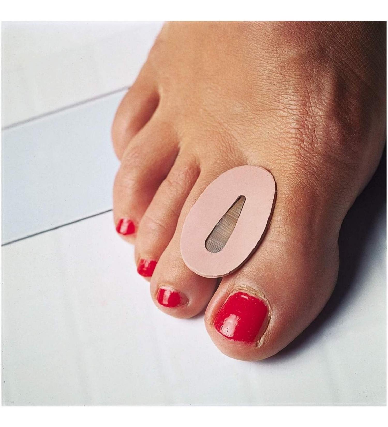 Hallux judge 2st.