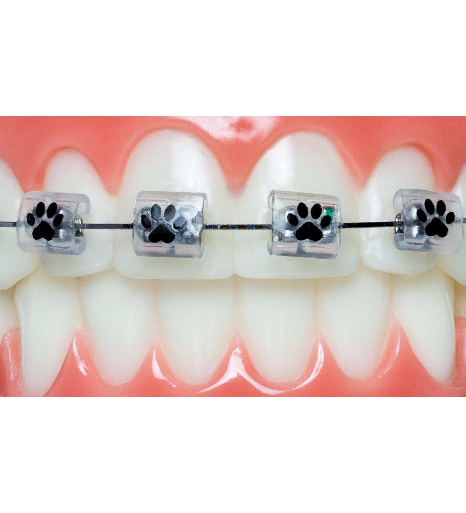 Snapcaps Paw Print 10 Ct: Bracket Cover Bumper for Braces - Orthodontic Accessories - Buy Online on GoSupps.com
