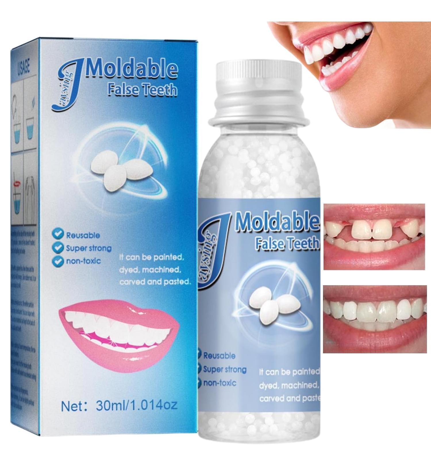 Temporary Tooth Repair Kit - Dental Glue for Fixing Missing Teeth - Buy Online on GoSupps.com