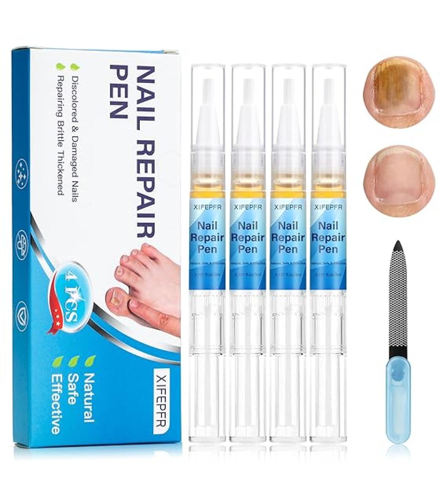 XIFEPFR Toenail Repair Pen - Nail Fingernail Repair Pen for Thick  Broken  Discolored Nails - Restores Healthy Strong Nails - 4PCS - Buy Online on GoSupps.com