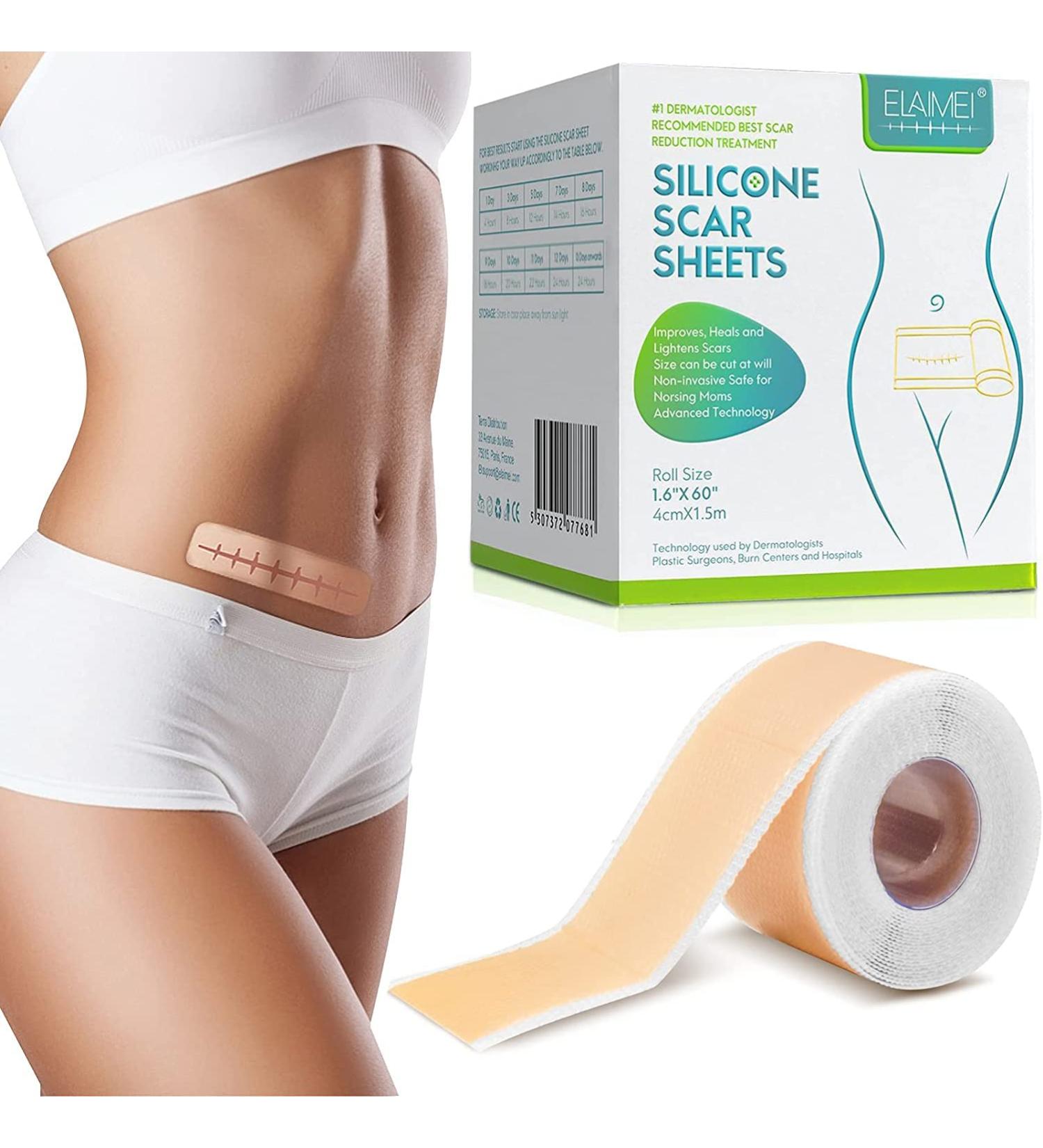 Silicone Scar Sheets - Medical Grade Removal Patches for C-Section, Surgery, Burn, Keloid, Acne - 1.6 x 60 - 1.5M - Buy Online on GoSupps.com