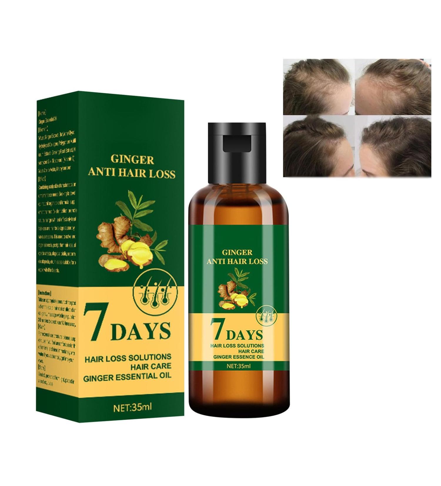 Ginger Huile de croissance des cheveux Ginger anti-chute 7 jours repousse 7 jours huile germ e au gingembre pour nourrir les racines des cheveux r pare les cheveux ab m s nourrit les racines des - Buy Online on GoSupps.com