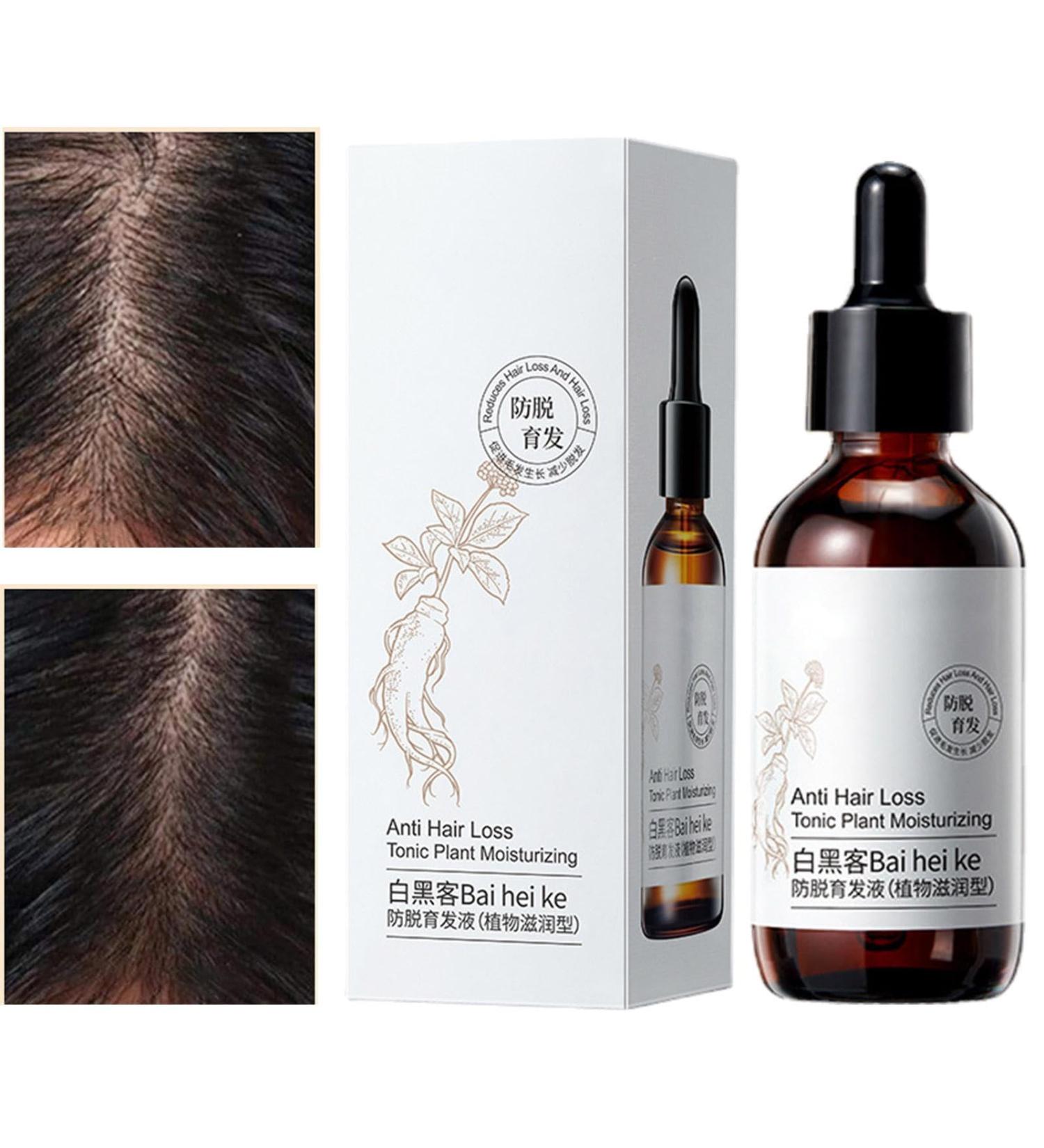  JPSDOWS Anti-hair oil - Anti-hair oil for women 60 ml anti-thinning hair products nourishing and strengthening hair growth oil from Jpsdows plants - Buy Online on GoSupps.com