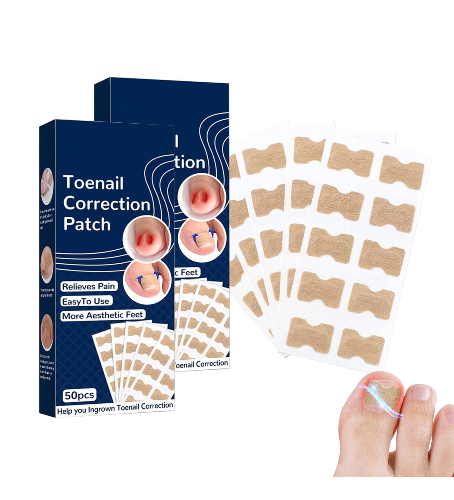 100 PCS Breathable Self-Adhesive Toenail Correction Patch - Ingrown Toenail Corrector Stickers Blue - Buy Online on GoSupps.com