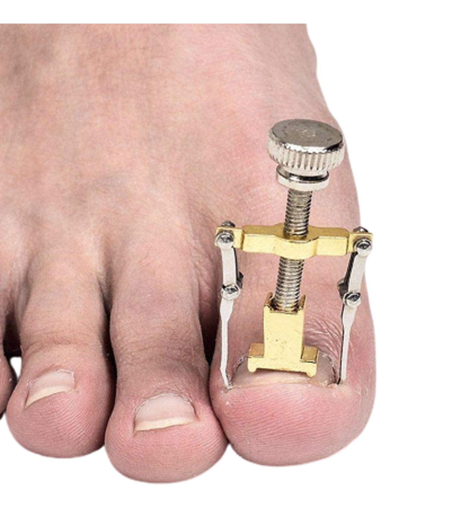 GLAMZA Ingrown Toenail Corrector Clamp - Safe & Effective Treatment Tool - Buy Online on GoSupps.com