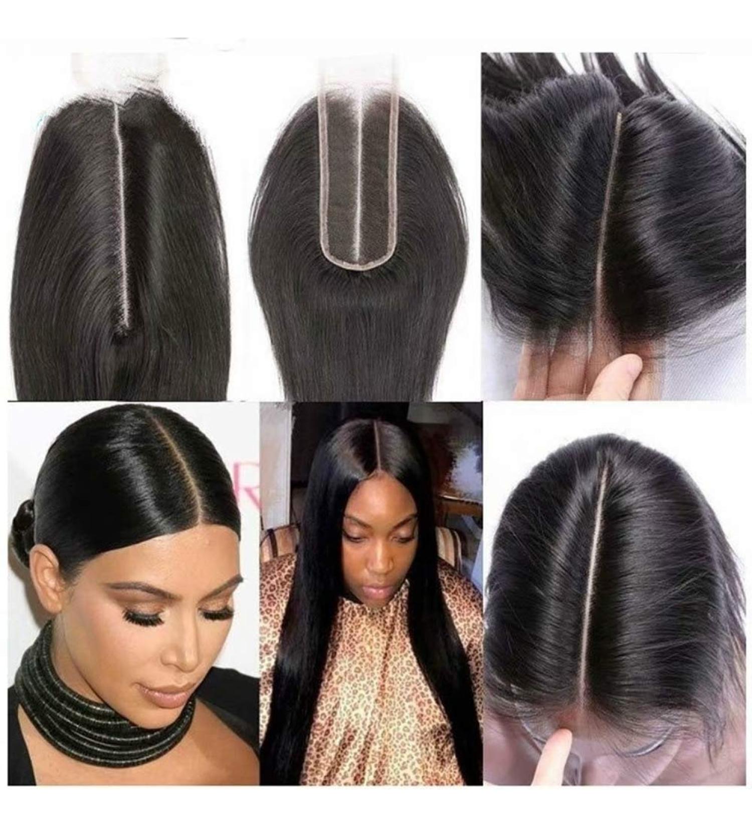 Risbaer 16 inch Brazilian 2x6 Straight Lace Closure Remy Hair - Natural Color - Buy Online on GoSupps.com