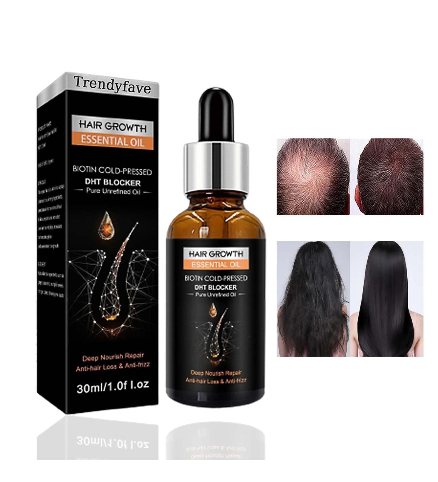 Trendyfave Hair Growth Oil Natural Herbal Hair Oils Ginger Hair Growth Serum and Enhancer Nourishing Scalp Hair Care Repair Dry & Restless Hair Serum Hair Thickening Oil for Thinning Balding Hair - Buy Online on GoSupps.com