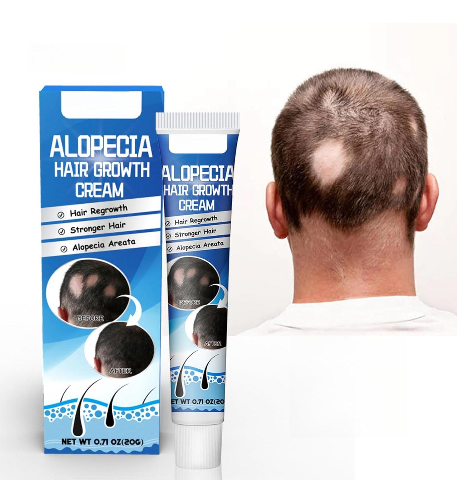 Sumifun Alopecia Hair Growth Cream - 0.71 Oz - Buy Online on GoSupps.com