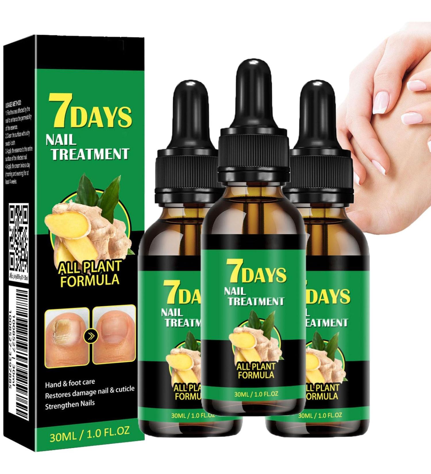 Traitement des ongles au gingembre huile pour cuticules au gingembre pour les ongles traitement des ongles de 7 jours huile nutritive pour ongles ab m s ongles fins r paration des cuticules - Buy Online on GoSupps.com