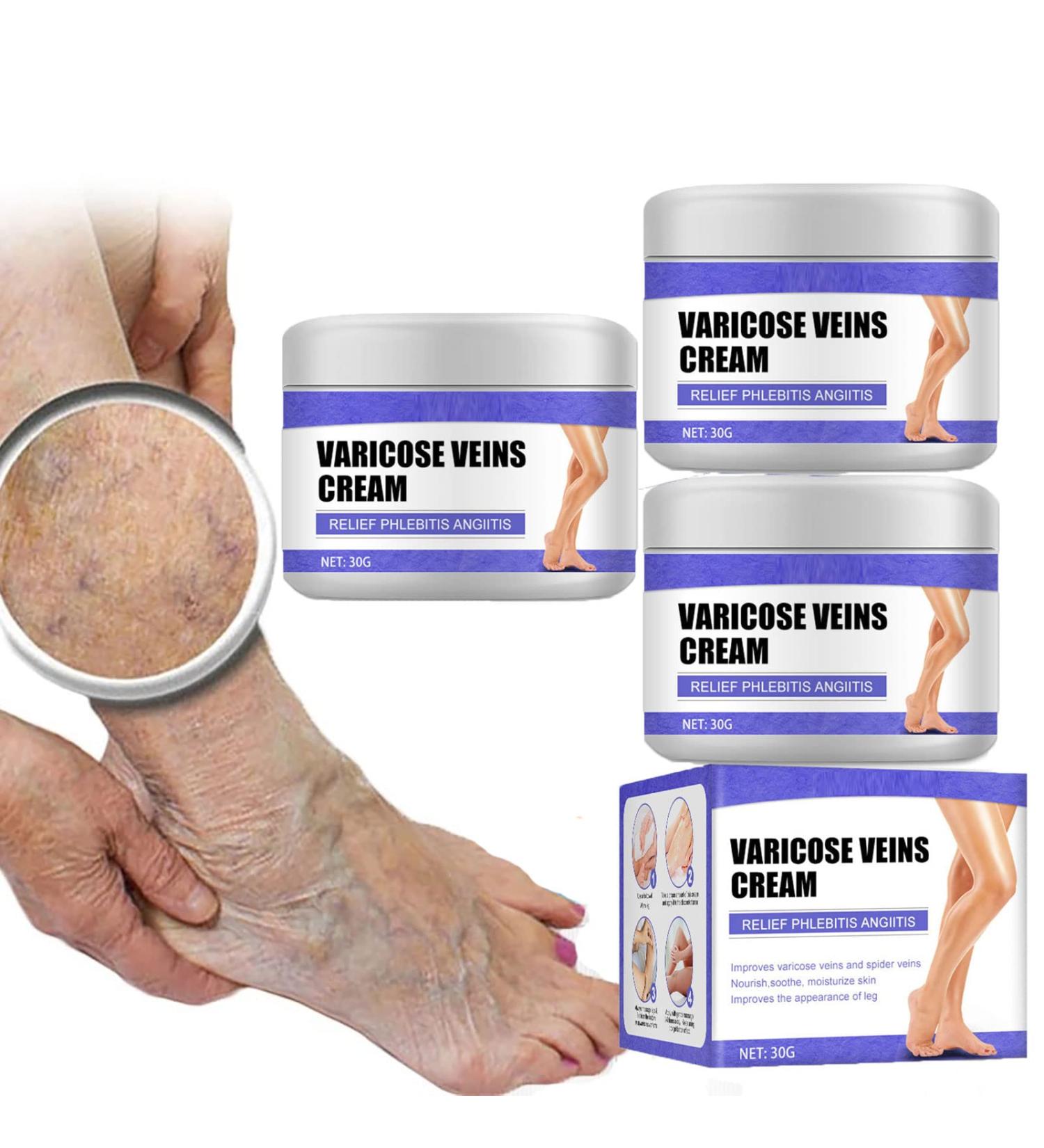 Vein Care Fading Cream 30g - Spider & Varicose Veins Treatment | Improve Leg Appearance & Circulation - 3 Pack - Buy Online on GoSupps.com