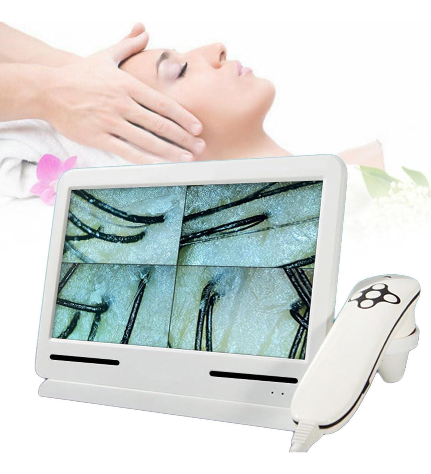 Scalp Hair Follicle Detector Professional Skin Diagnostic Hair Analyzer Scalp Microscope Skin Moisture Analyzers Skin Diagnosis Scanner Provides Clearer Detection - Buy Online on GoSupps.com