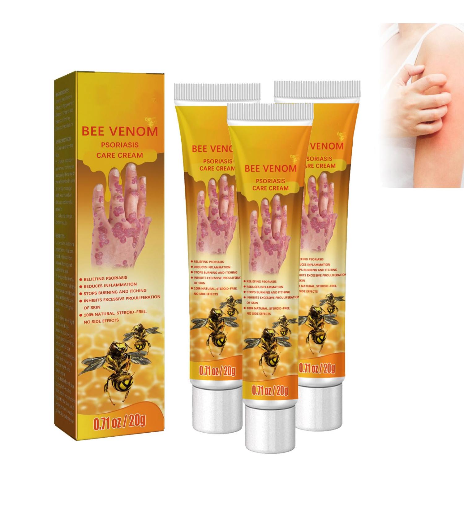ROKOBN Youth Bee Venom Psoriasis Treatment Cream 20g - Professional Soothing Skin Care for Psoriasis (3PCS) - Buy Online on GoSupps.com