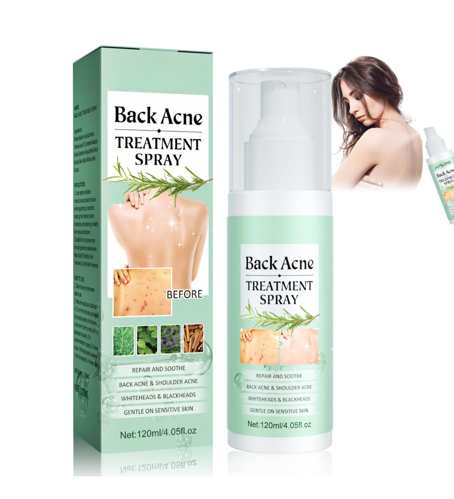  Miioto Back Acne Treatment Spray Back Acne and Chest Acne Removes Excess Oil on the Body and Penetrates Pores Soft and Non-Irritating 120ml - Buy Online on GoSupps.com