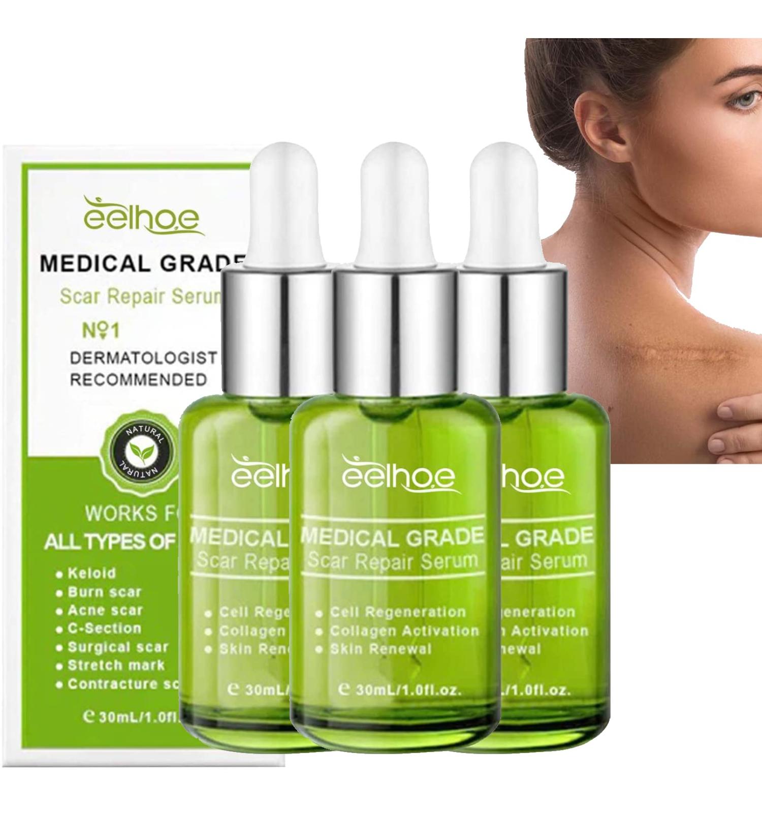 Advanced Scar Repair Serum - Medical Grade Spray for Acne, Surgical, Stretch Marks & Burns - Skin Repair Treatment (3PC) - Buy Online on GoSupps.com