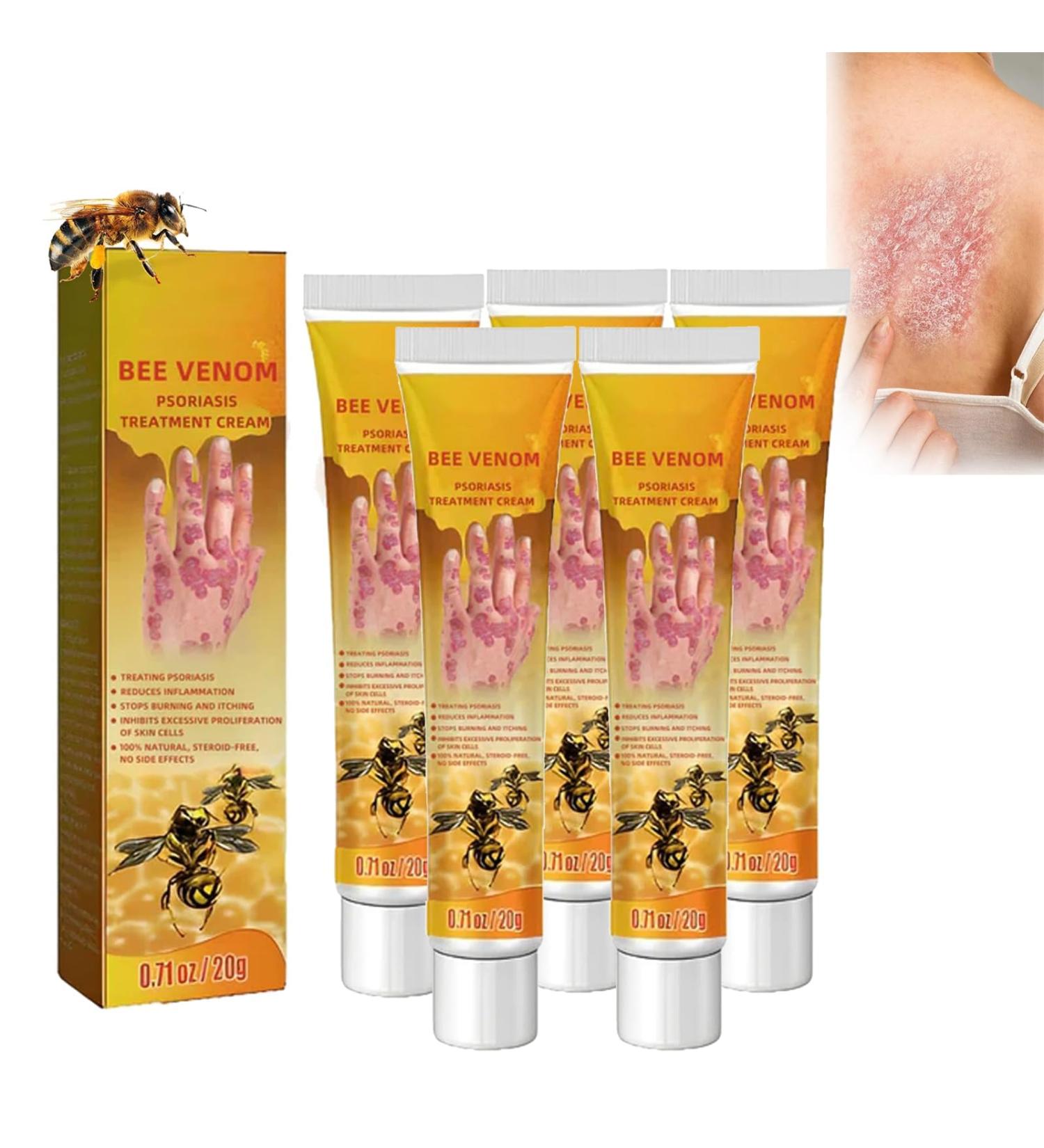 Professional Psoriasis Treatment Cream with New Zealand Bee Venom - Soothing & Moisturizing Formula - 5PCS - Buy Online on GoSupps.com