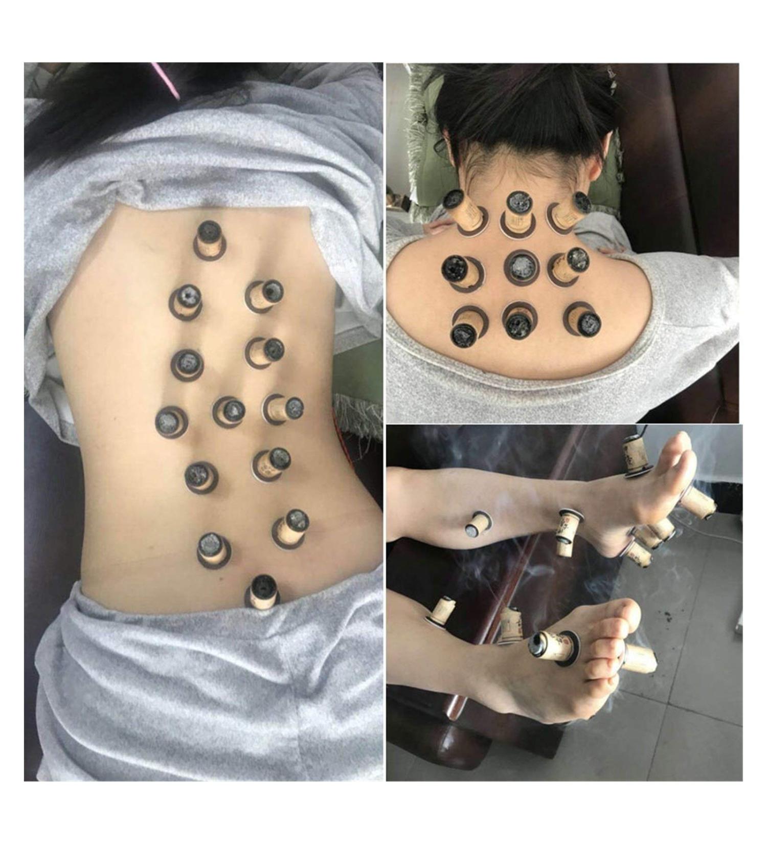 YANHAO Moxa Rolls - 30pcs Self-Stick Moxibustion Stickers for Meridian Heating | Natural Artemisia Therapy - Buy Online on GoSupps.com