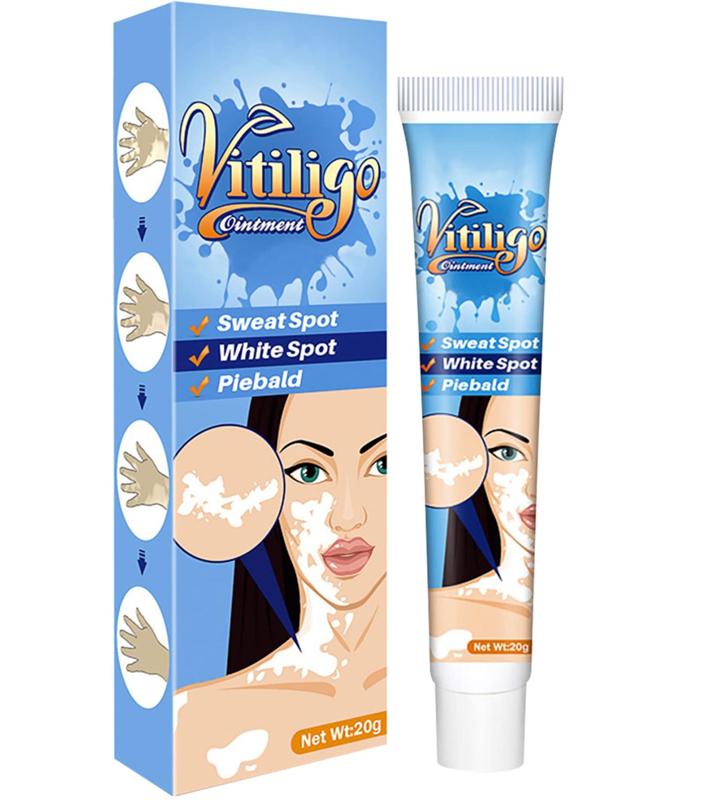 Vitiligo Cream for Skin Pigmentation | Reduce White Spots Treatment - Buy Online on GoSupps.com