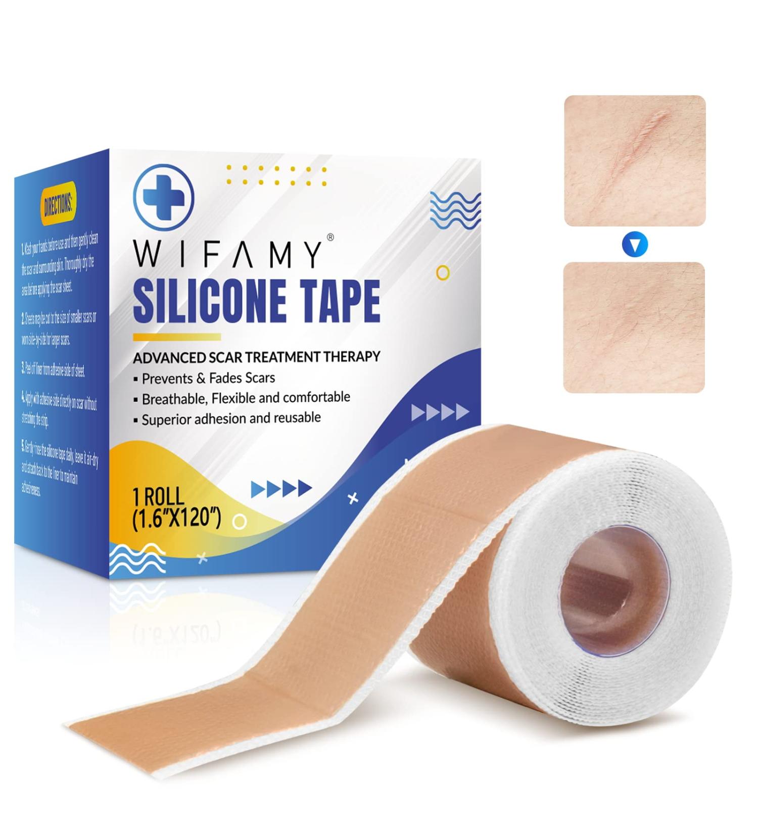Silicone Scar Sheets & Tape 1.6x120 - Reusable Treatment for C-Section, Burn, Surgery & Acne Scars - Buy Online on GoSupps.com