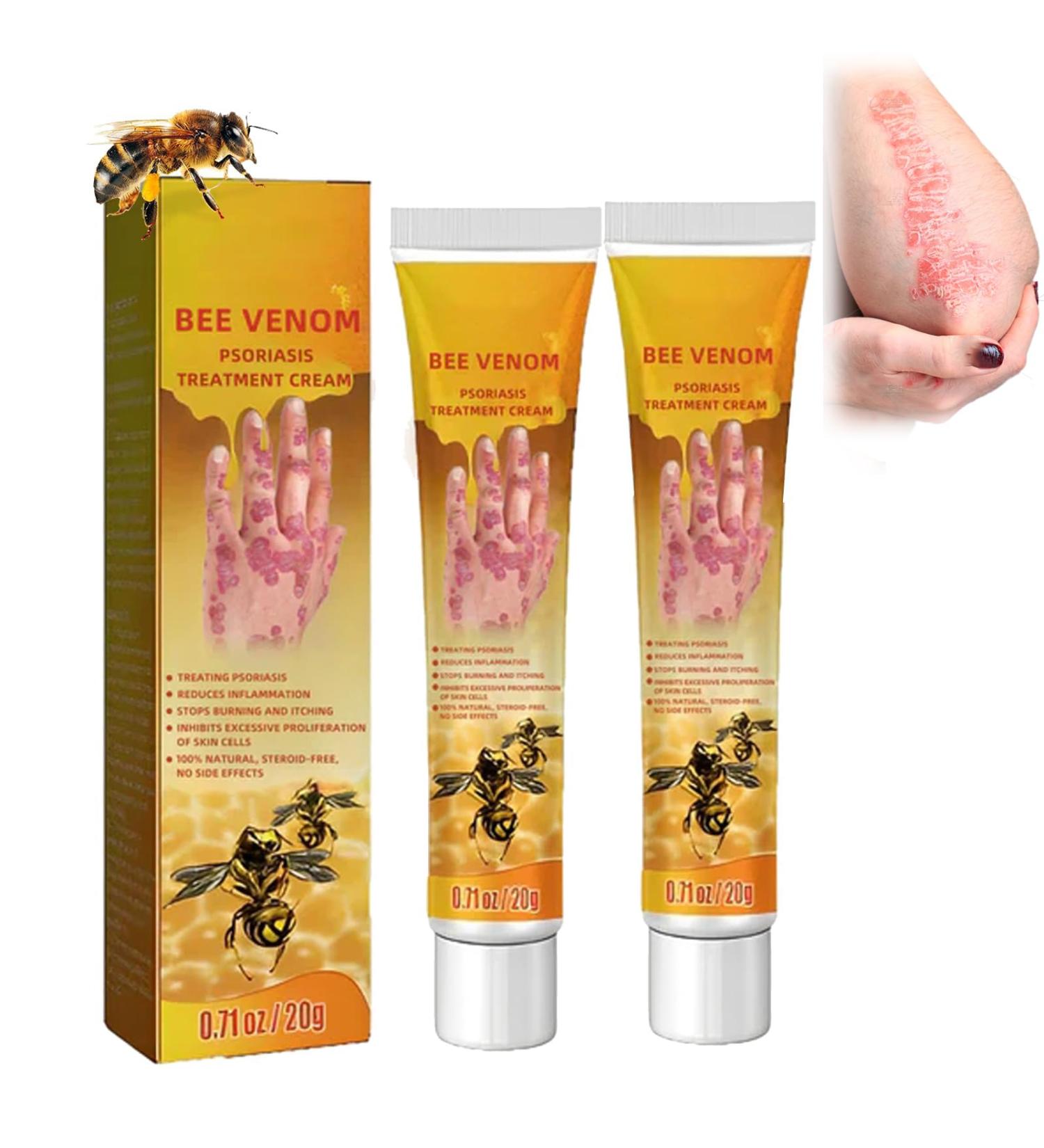 Bee Venom Psoriasis Treatment Cream - Soothing & Moisturizing for Skin - 2pcs - Buy Online on GoSupps.com