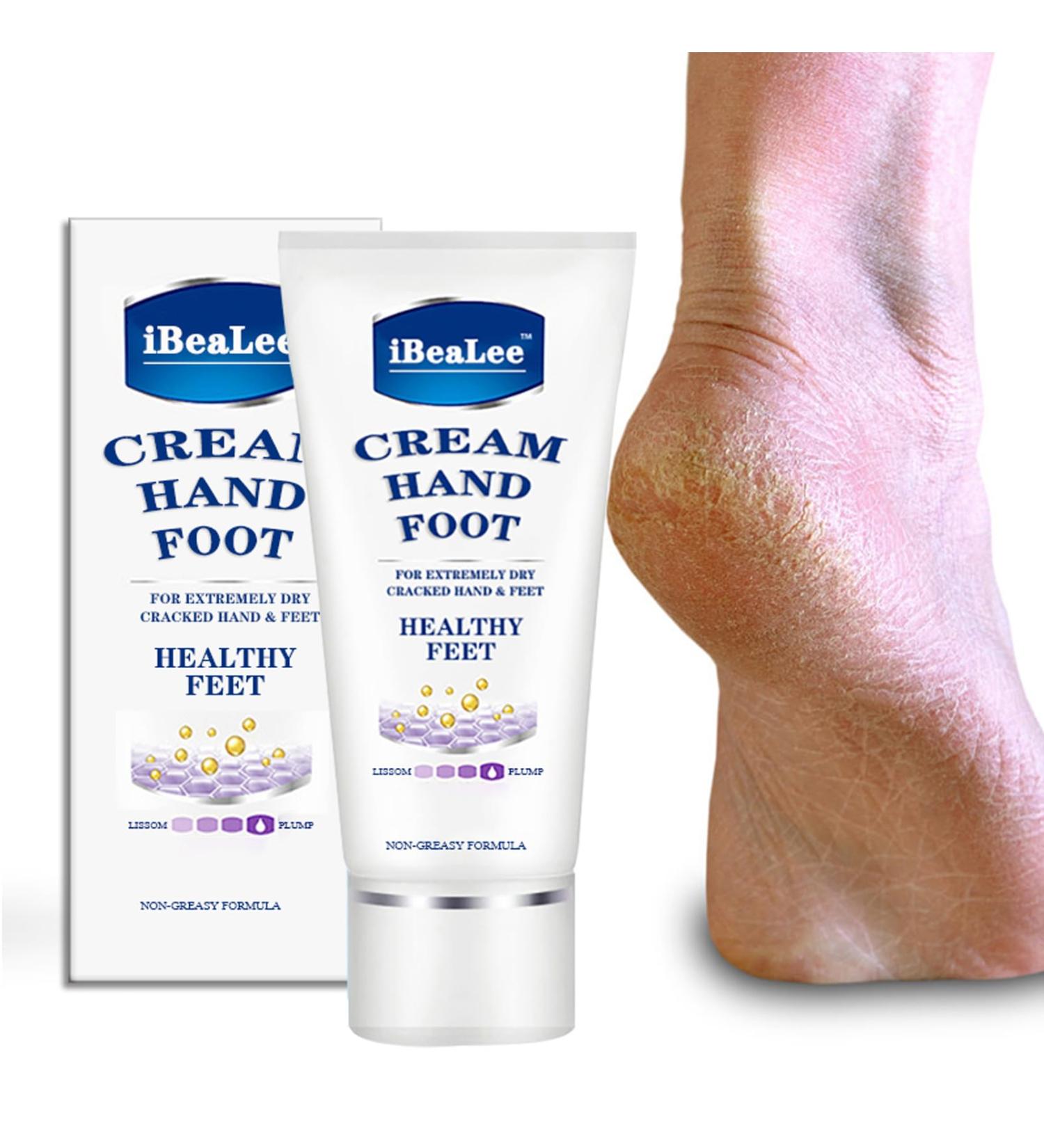Urea Foot Cream for Dry Cracked Heels and Feet Cracked Foot Repair Ultra-Hydrating Foot Cream 35g Callus Remover For Dry And Hard Skin Foot Lotion for Dry Cracked Feet Heals & Moisturizes - Buy Online on GoSupps.com