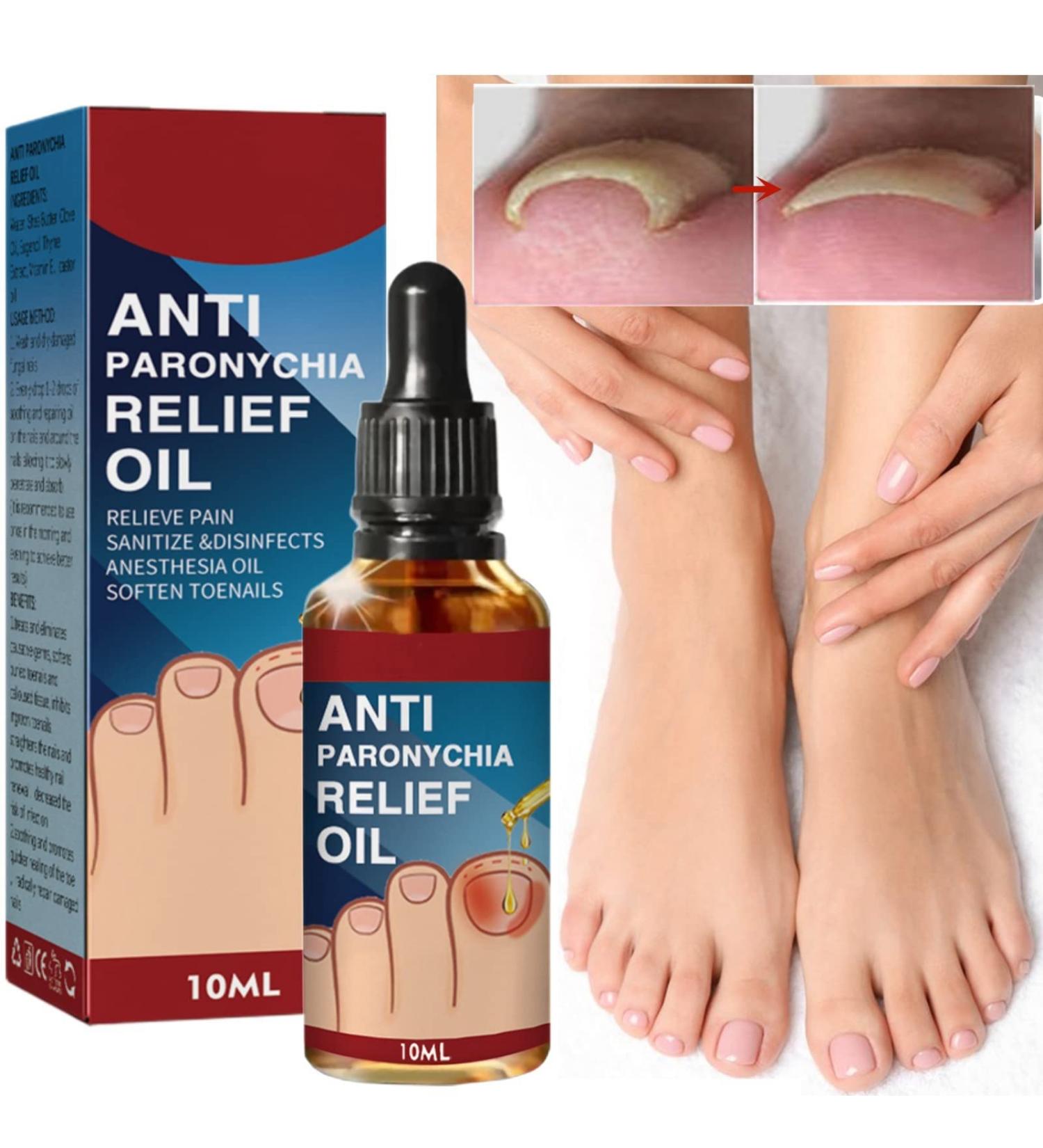 Ingrown Toenail Treatment Nail Growth Treatment Fungal Nail Treatment Ingrowing Toenail Treatment Ingrown Toenail Corrector Treatment for Ingrown Toenail Cuticle Oil Nail Strengthener for Damaged Nail - Buy Online on GoSupps.com