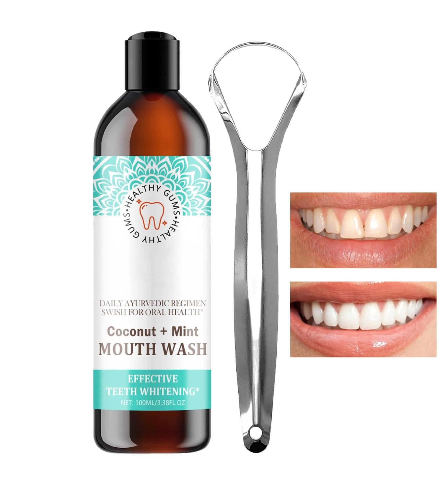 Coconut Oil Mouthwash for Fresh Breath | Brightening Teeth & Healthier Gums | Natural Coconut & Peppermint Oil - Buy Online on GoSupps.com