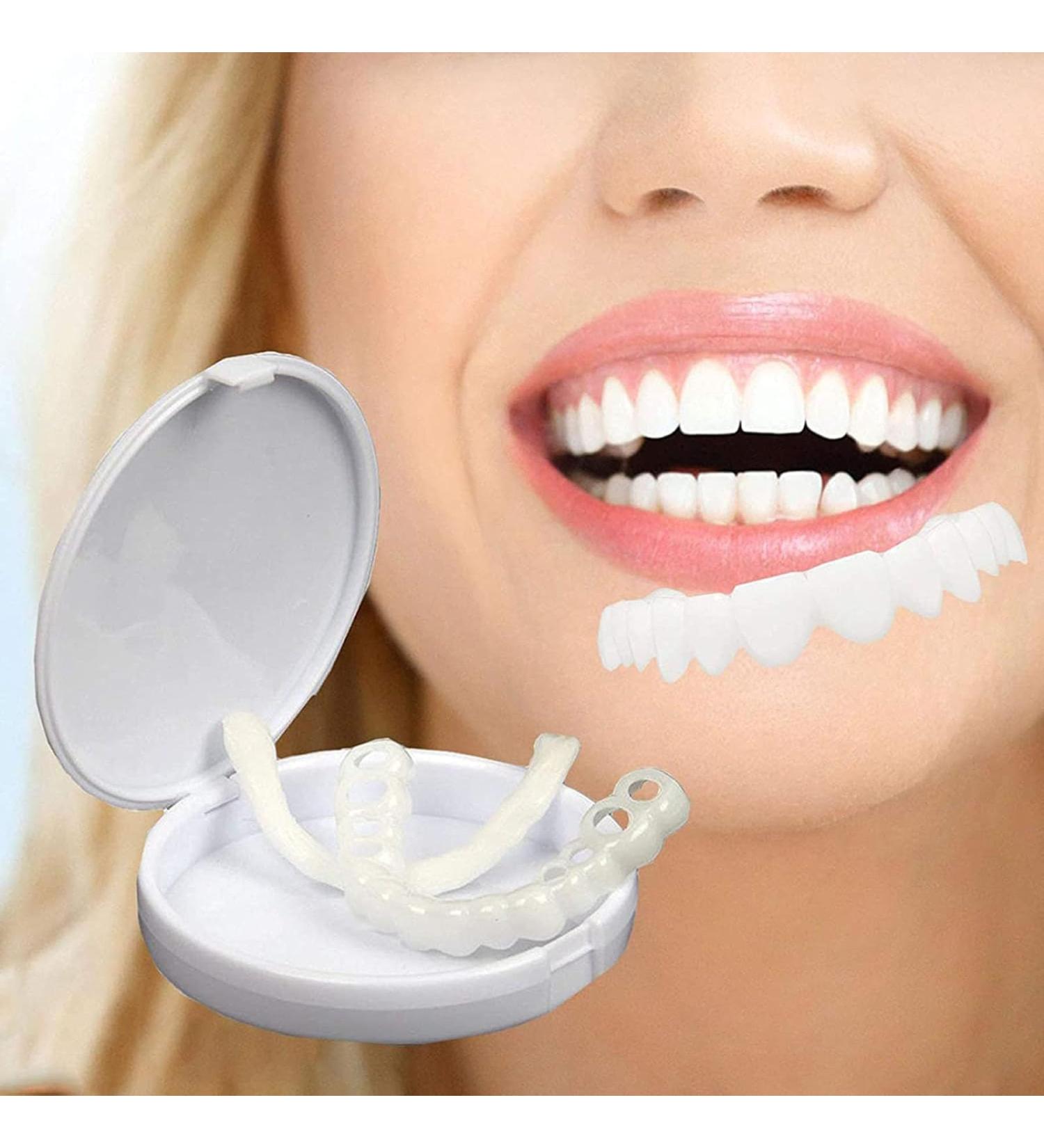 Uqlpxz 2 Pairs Fake Braces Veneers - Instant Cosmetic Dental Prosthesis for Bad Teeth - Buy Online on GoSupps.com