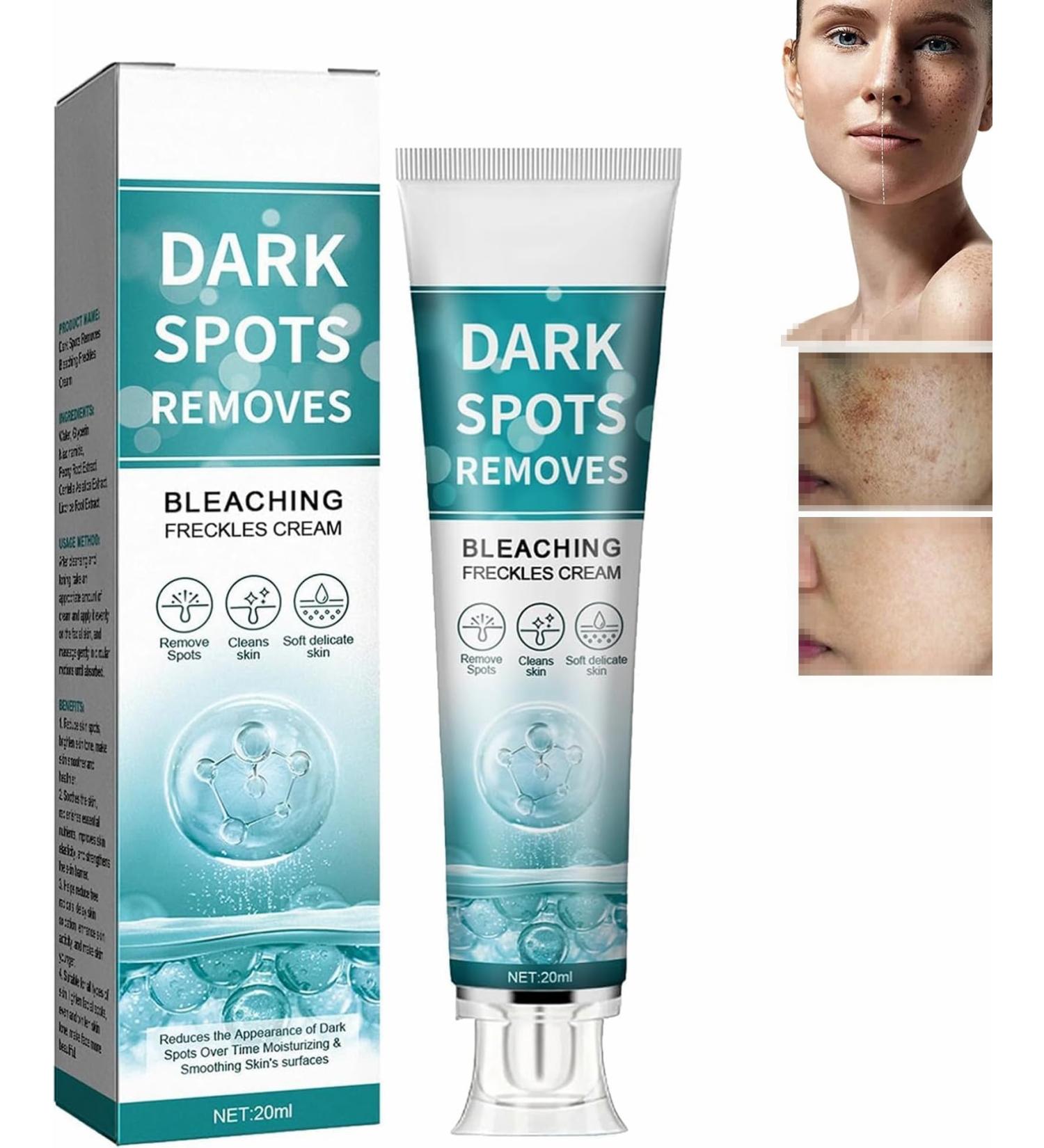 Fade Stain Beauty Cream Freckle Remover Cream Dark Spot Remover for Face Age Spot Remover Corrector Cream for Face and Body Dark Spot Remover Dark Spot Remover for Face and Body - Buy Online on GoSupps.com