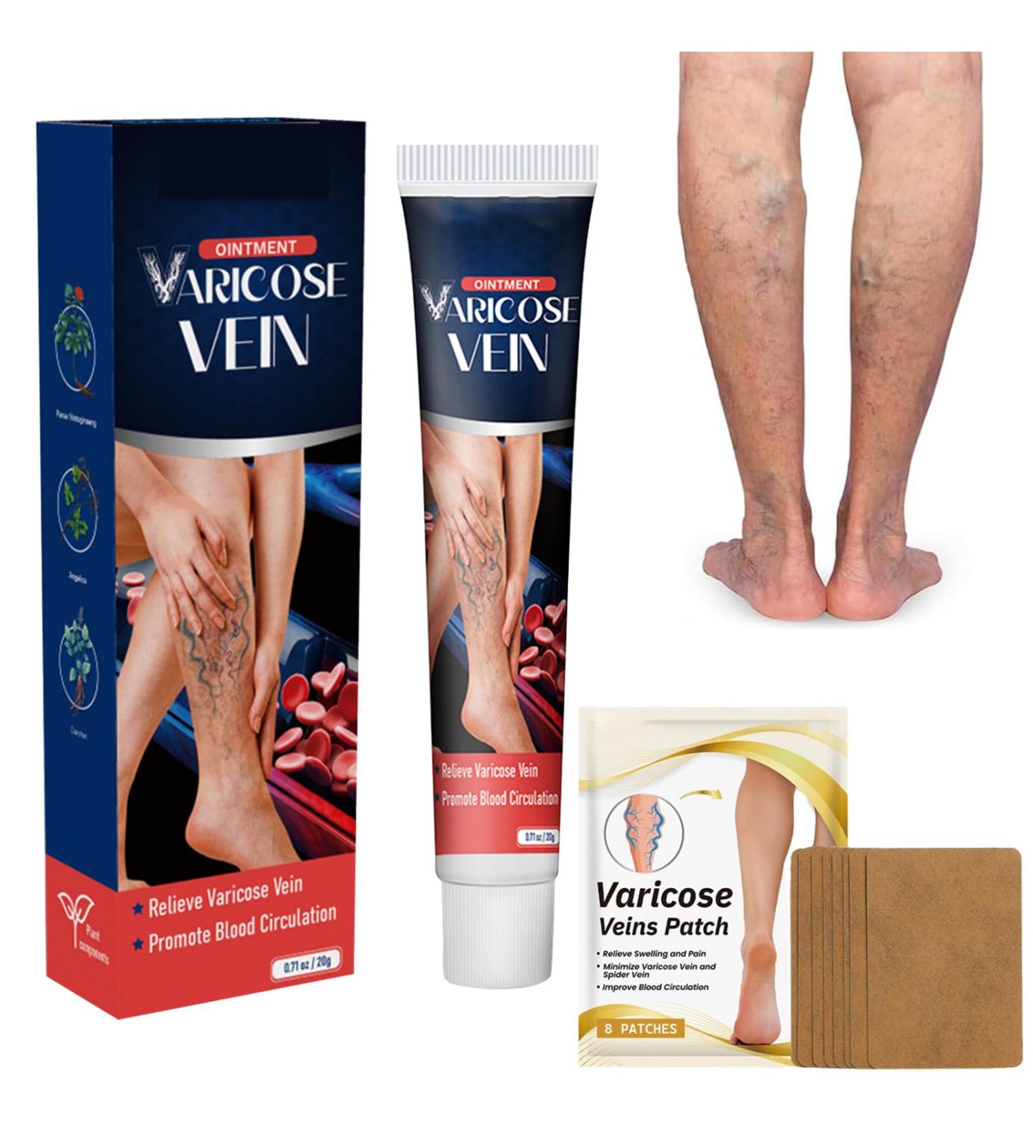 Cr me Contre Les Varices Cr me Pour Les Varices R paration Des Jambes D'Araign e Convient Tous Les Types De Peau apaise et hydrate rapidement - Buy Online on GoSupps.com