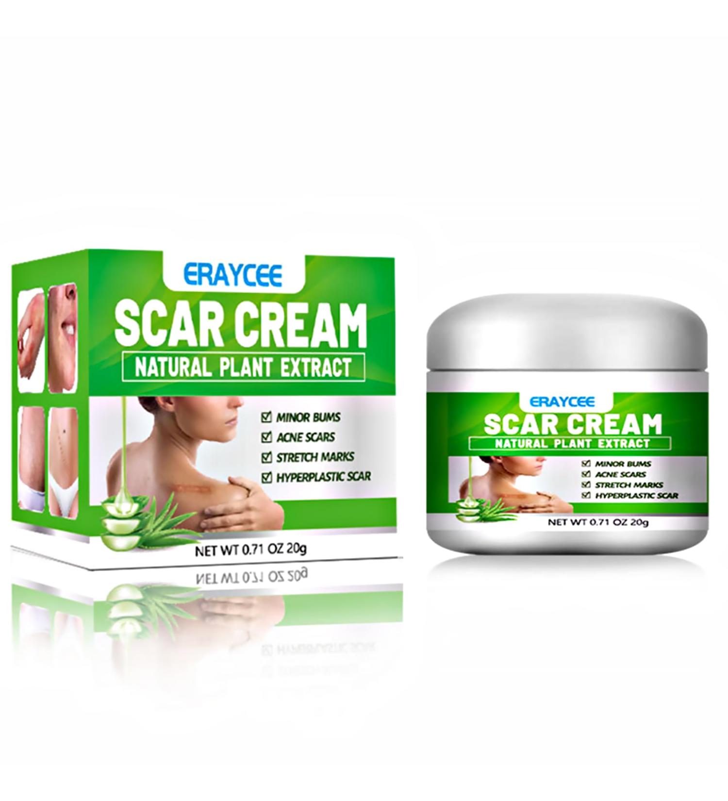 Natural Aloe Vera Scar Cream 20g Helps Soothe Acne Scars C-Section Scars Burns And Surgery Scars Works On Both Old And New Scars - Buy Online on GoSupps.com
