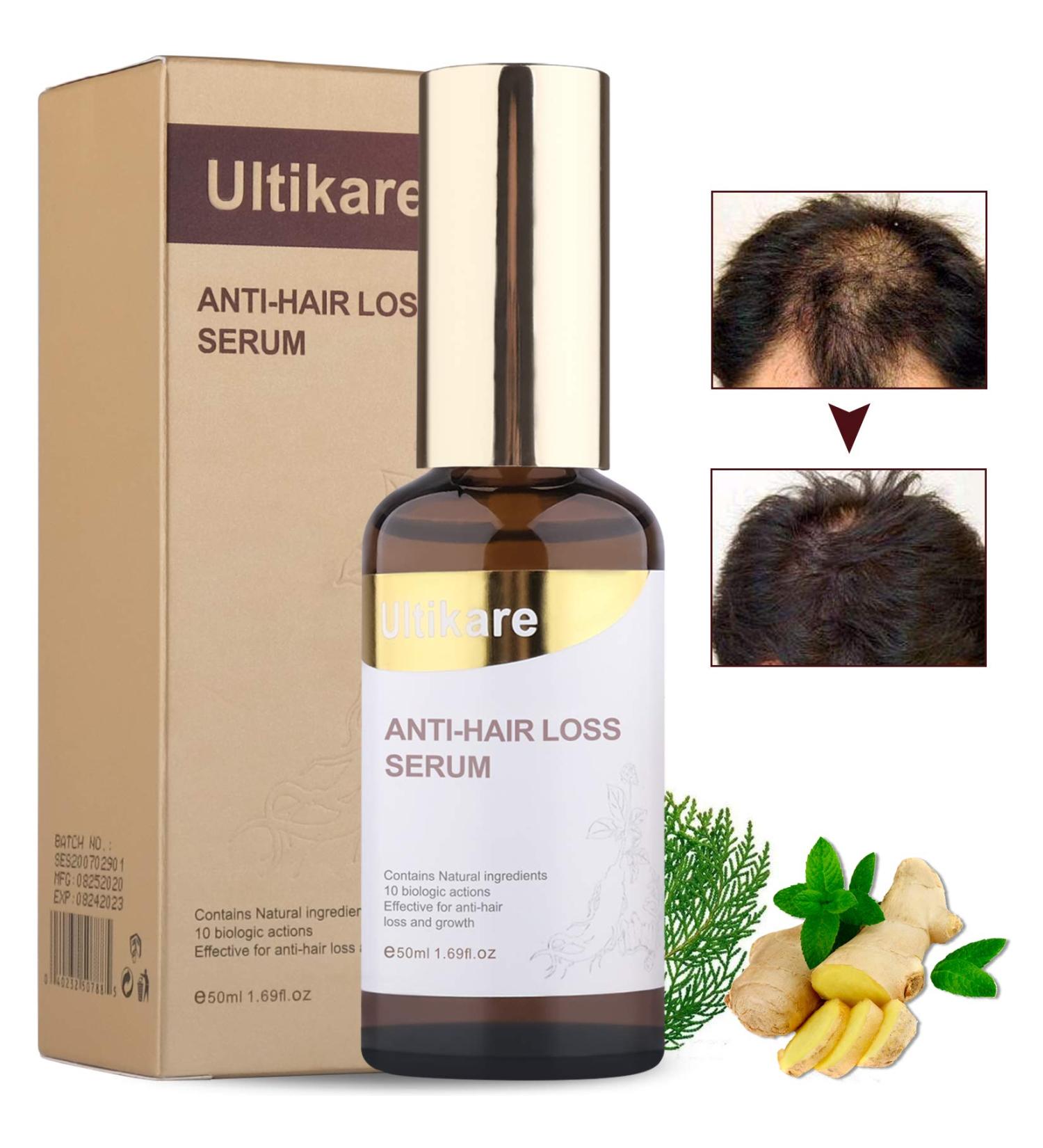 Ultikare Ginger Hair Growth Oil - Premium Ginger Serum for Men & Women | Stop Hair Loss & Promote Hair Growth | 1.69 Fl Oz - Buy Online on GoSupps.com