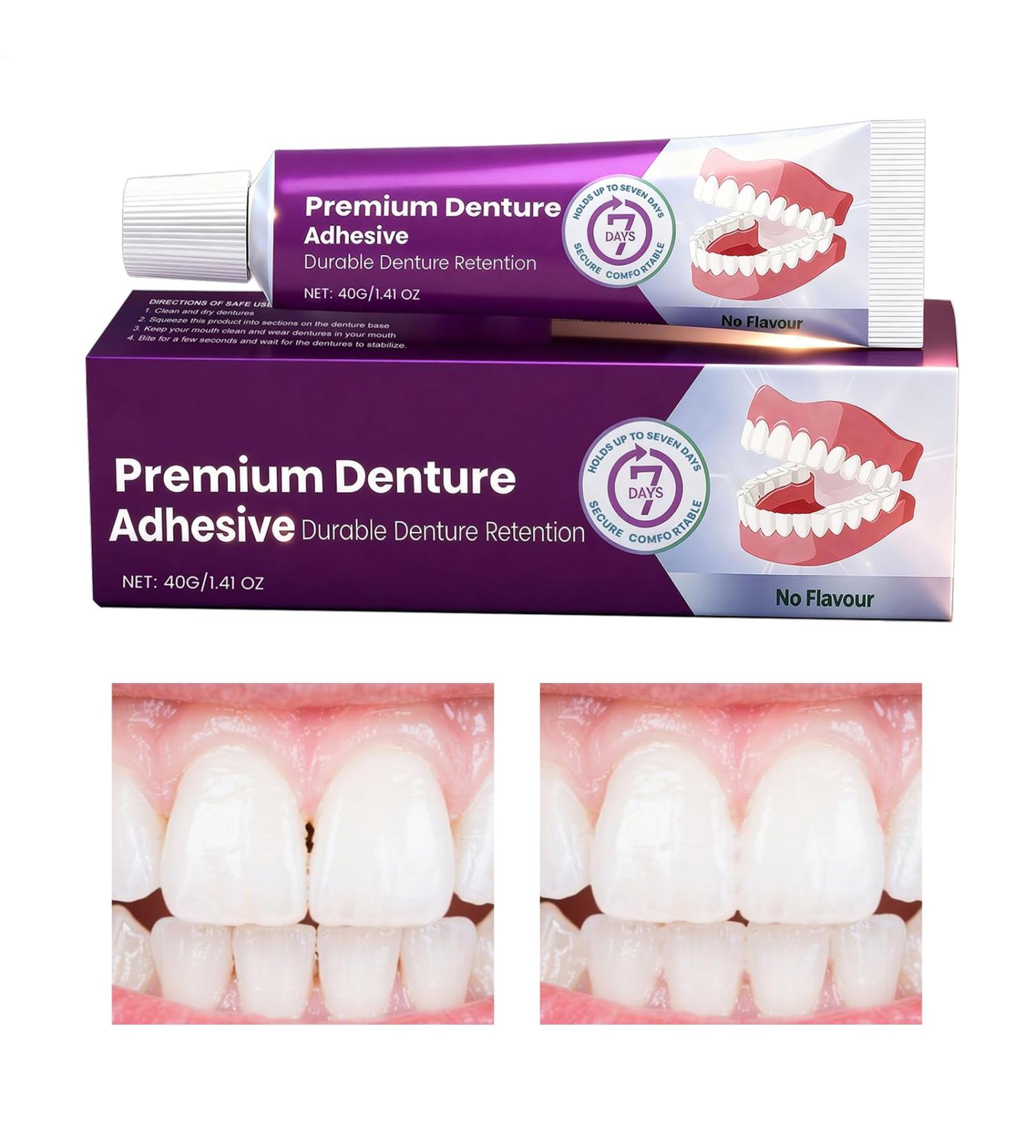 Qkbuza Denture Adhesive Maximum Holding Force 40g Repair Pad and SealantDenture Fixative For Daily Use by Women and Adults with Full or - Buy Online on GoSupps.com